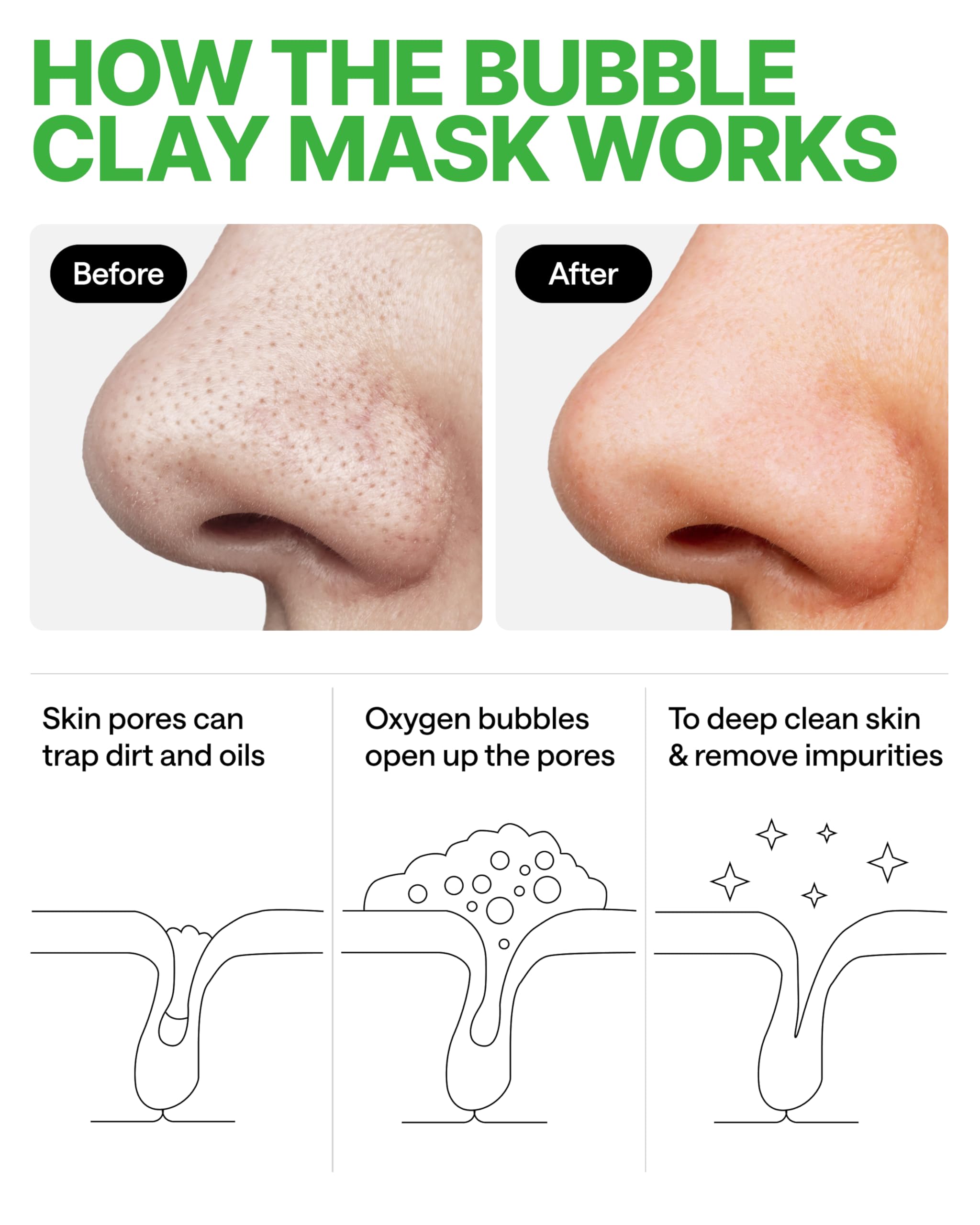 WONDER FAMILY Korean Carbonated Bubble Clay Mask for Face – Black Head Remover for Face – Deep Pore Cleansing Mask – Facial Blackhead Remover Mask – Pack 7 Korean Face Masks Skincare