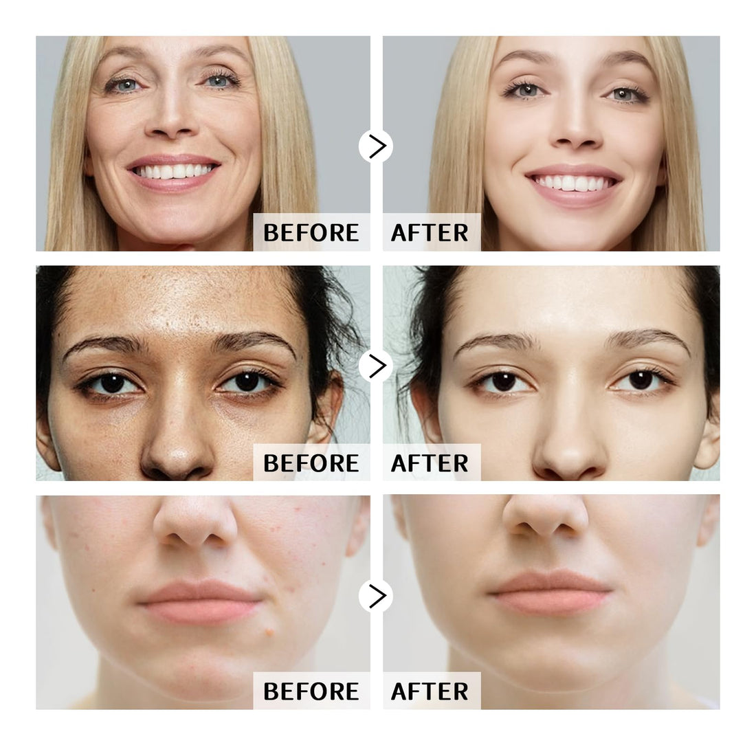 Anti Aging Face Serum Set 2PCS, Niacinamide & Hyaluronic Acid Serums for Wrinkles and Fine lines, Improves Skin Texture, Moisturising Set Oil Control & Pore Shrinkage for All Skins