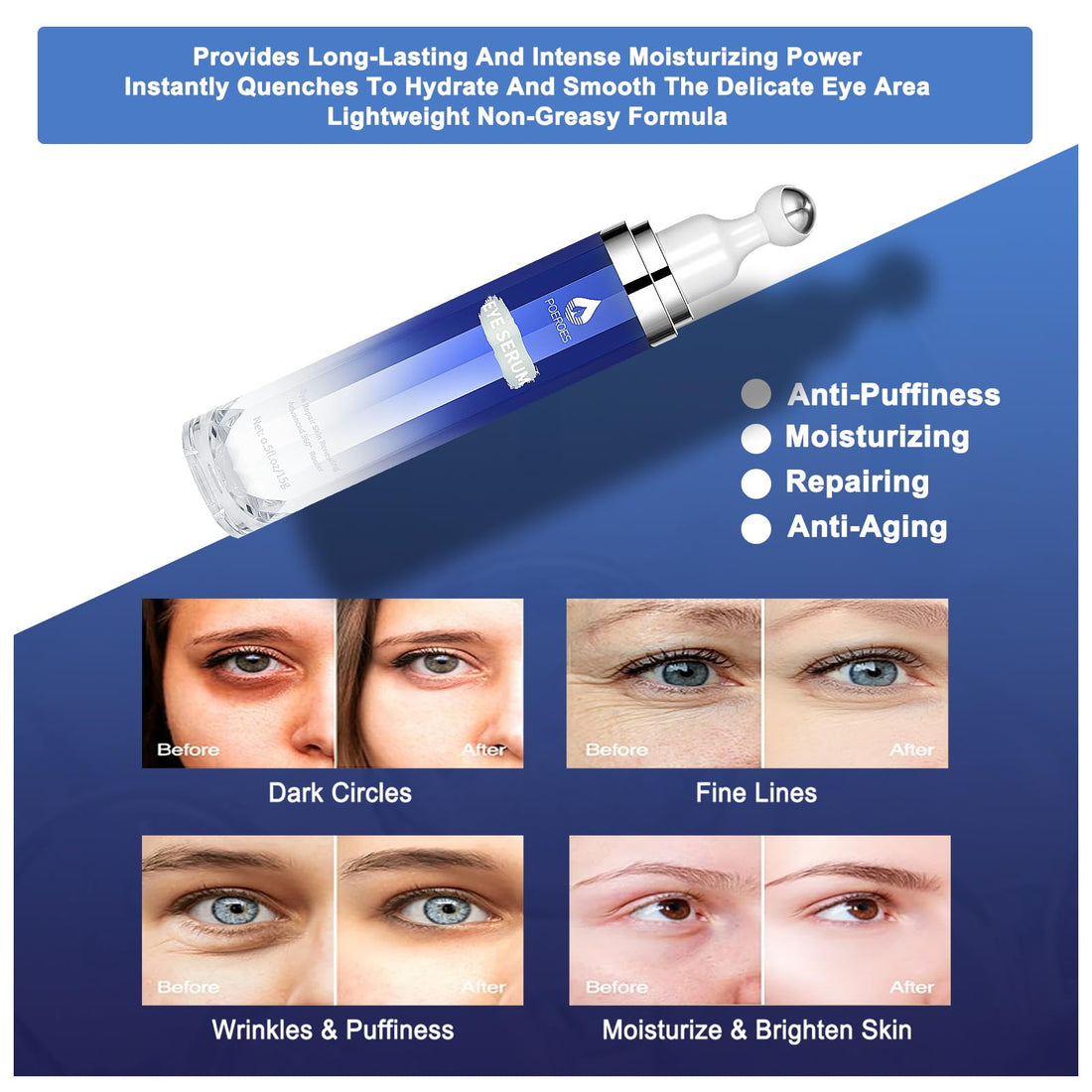 Poeroes Eye Serum with 8% Caffeine 8% Retinol Hyaluronic Acid Niacinamide peptides for Puffy Bags Fine Lines Dark Circles Wrinkles, Under Eye Cream with 360° Roller Massage Ball, 0.5 fl. oz