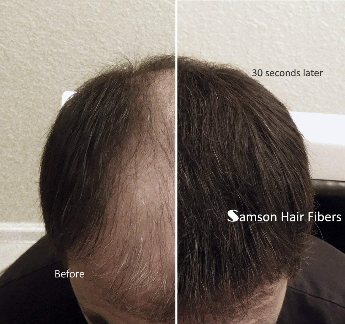 Refill Kit Hair Building Fibers Black By Samson Large 25 Grams Made In Usa Hair Loss Concealer