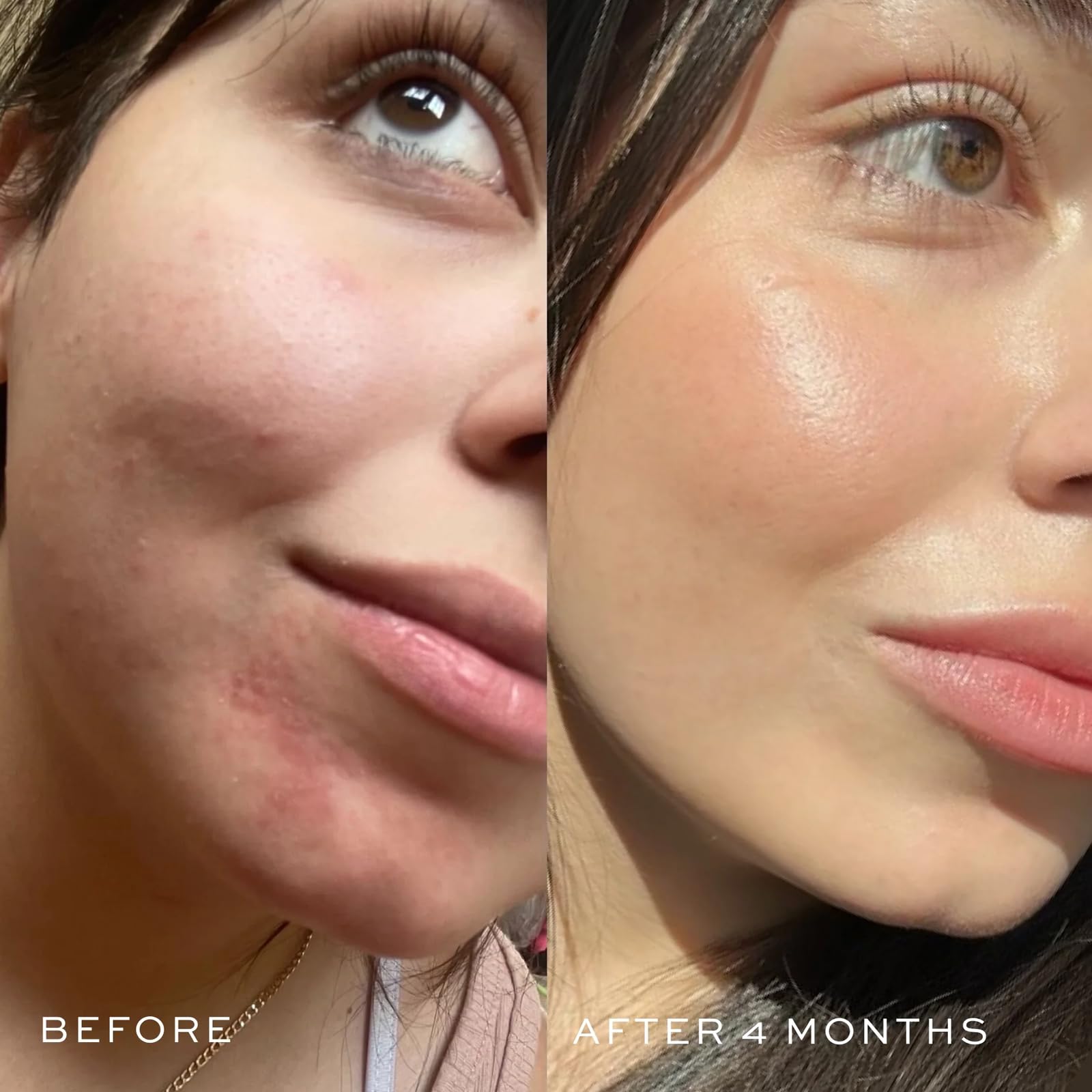 DIME Beauty Blue Facial Oil, Blemish Spot Treatment with Blue Tansy Oil, Black Cumin Seed Oil, Rosehip Oil, and Grapeseed Oil, 1 oz / 30 mL