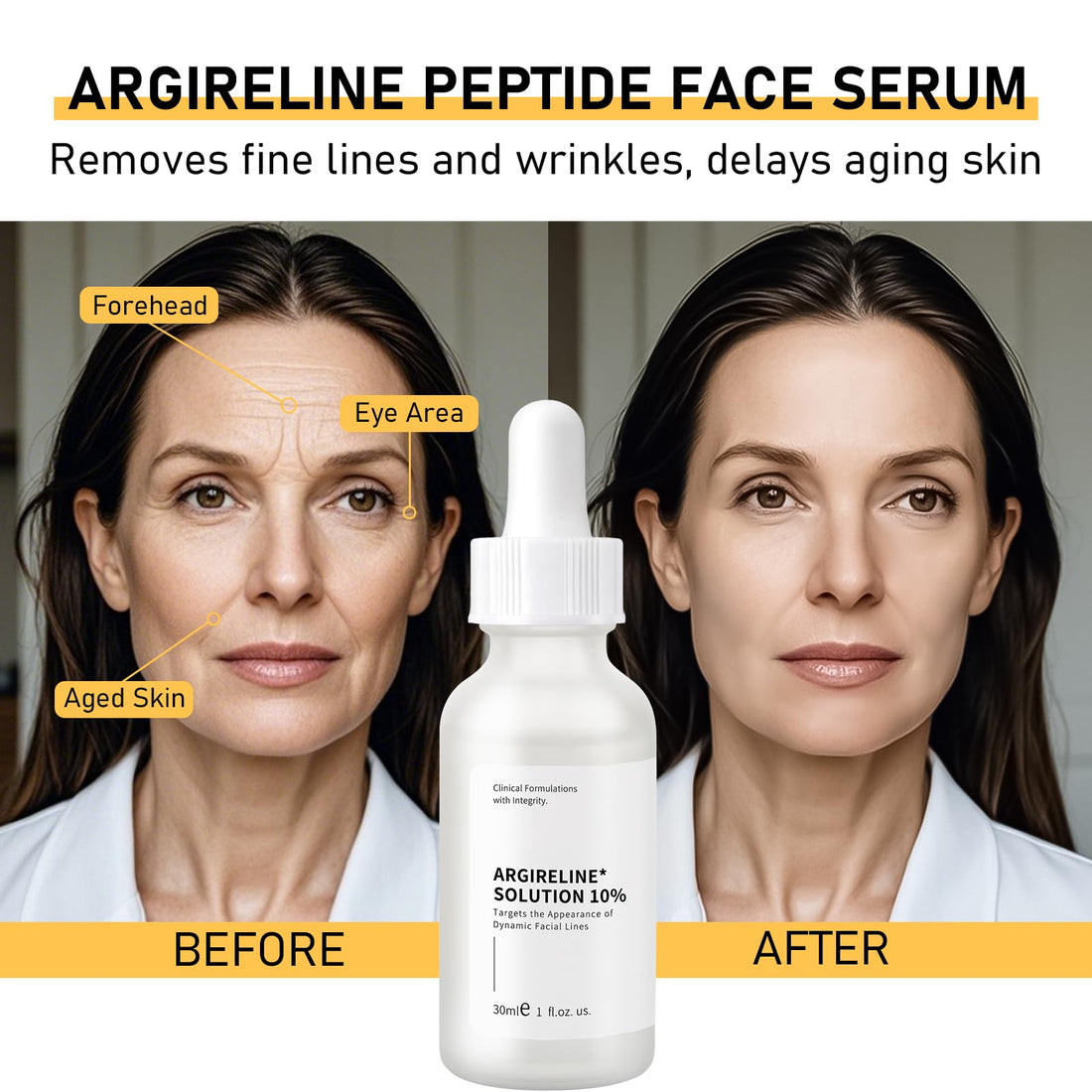 Argireline Serum For Oily Skin, Advanced Anti-Wrinkle Facial Serum For Women, 30 ML/ 1 PCS Moisturizing Argireline 10% Solution For Face, Argireline Peptide.