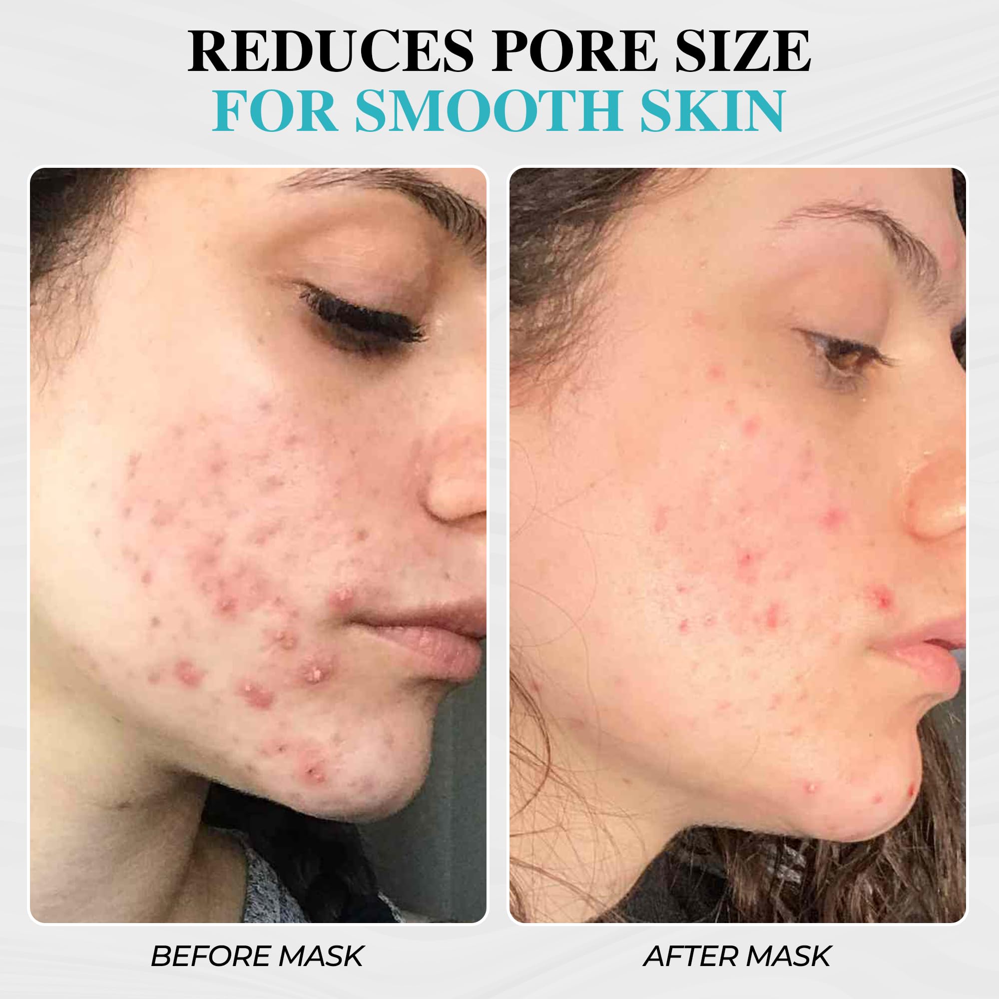 Aromasong Dead Sea Mud Mask 100% Pure for Face and Body - Spa Quality Pore Reducer for Acne, Blackheads & Oily Skin, Cleansing Natural Skin Care for Women and Men - 8 oz