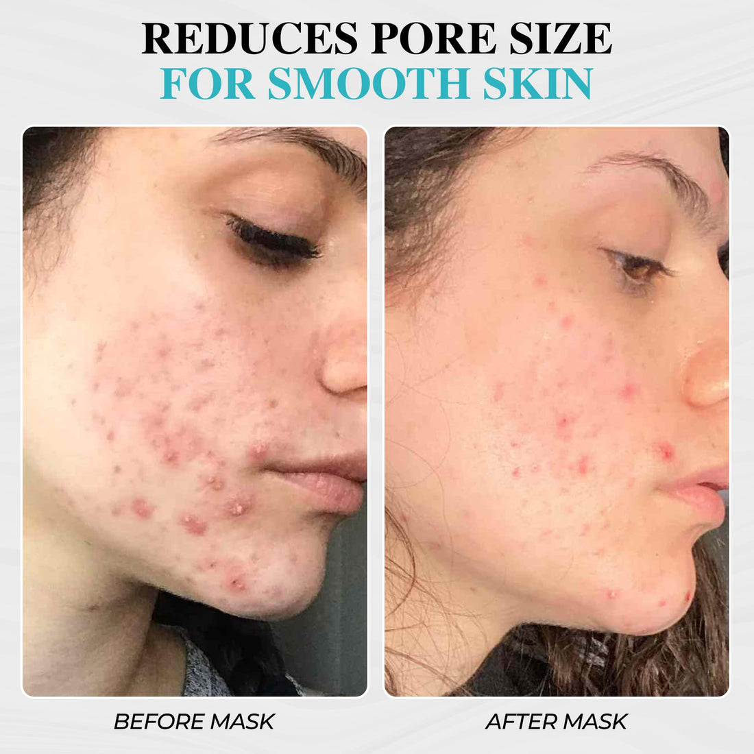 Aromasong Dead Sea Mud Mask 100% Pure for Face and Body - Spa Quality Pore Reducer for Acne, Blackheads & Oily Skin, Cleansing Natural Skin Care for Women and Men - 8 oz