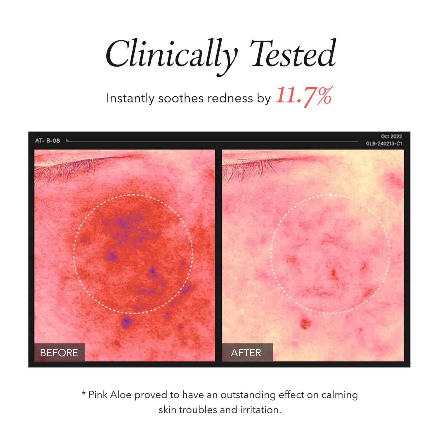 APRILSKIN Pink Aloe Facial Polish Cleanser | Gentle Exfoliation with Mungbean & Soybean Scrub | Removes Waterproof Makeup & Sunscreen | Non-Comedogenic Cleanser for All Skin Types | Korean Skincare