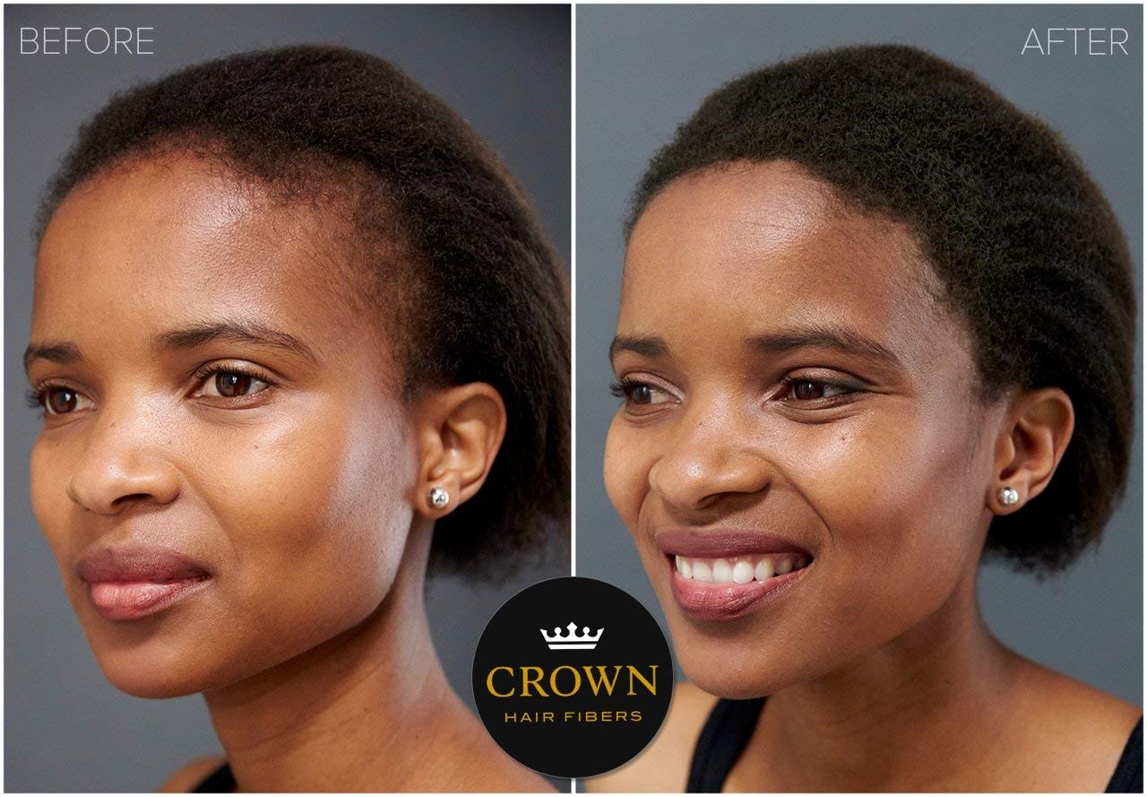 CROWN Hair Fibers - Best Keratin Hair Fibers Instantly Thickens Thinning or Balding Hair for Men and Women - Natural Hair Loss Concealer 0. 87oz - Black