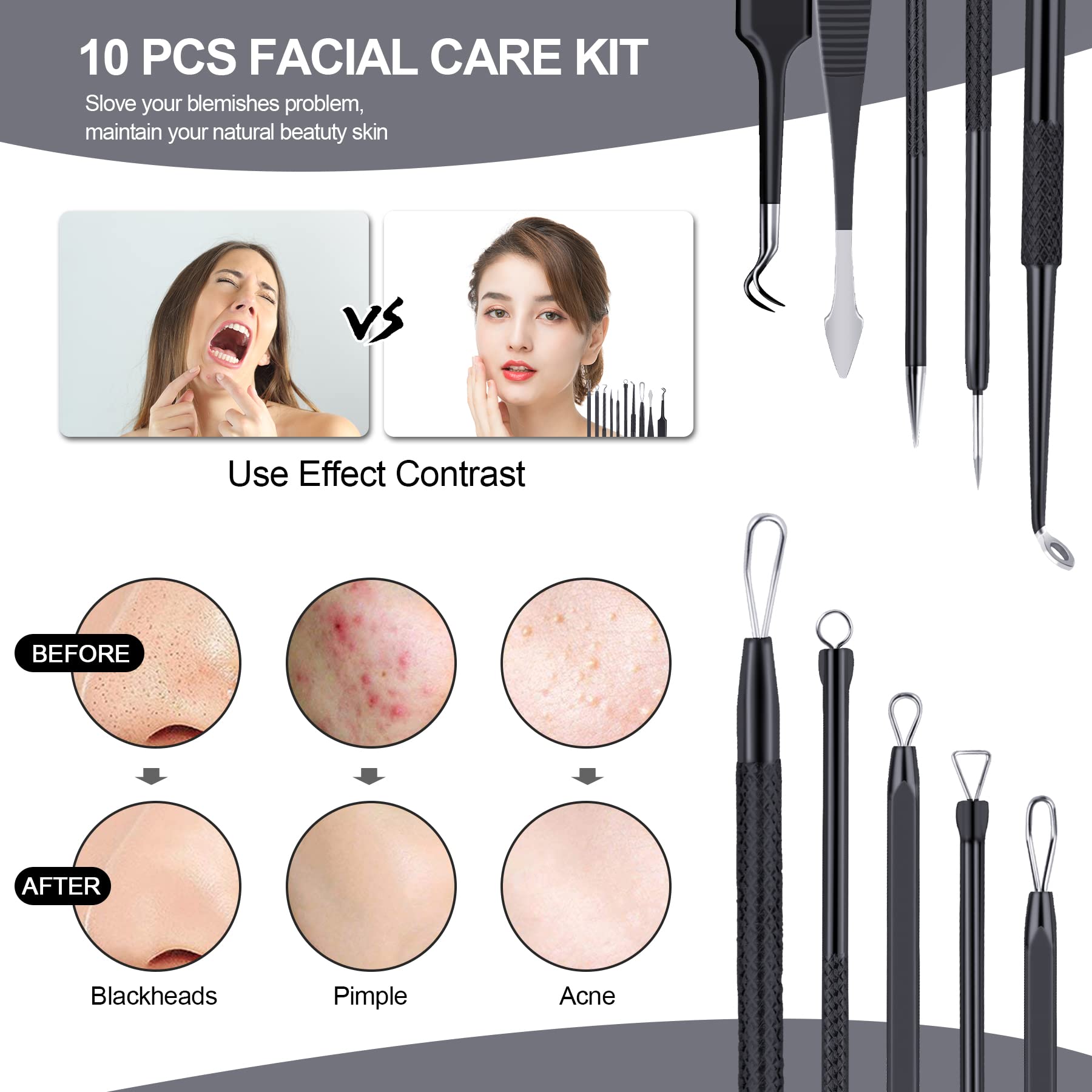 Pimple Popper Tool Kit 10 Pcs, MENOLY Newest Blackhead Remover Pimple Comedone Extractor Tools for Easy and Fast Removal of Blackheads, Pimples and Blemish on Face, with Elaborate Leather Bag