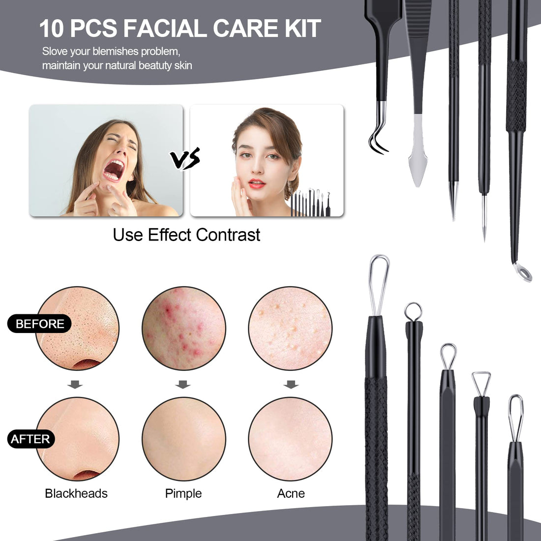 Pimple Popper Tool Kit 10 Pcs, MENOLY Newest Blackhead Remover Pimple Comedone Extractor Tools for Easy and Fast Removal of Blackheads, Pimples and Blemish on Face, with Elaborate Leather Bag