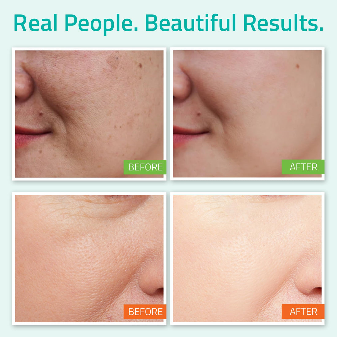 Best Anti-Aging 3 Pack Skin Care System by YEOUTH, Professional Grade Hyaluronic Acid Plus, Patented L22 Facial Moisturizer, and Balancing Facial Toner - You will love it or your money back!