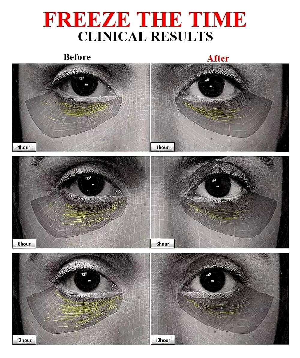 WHITESILK [K-Beauty] [SCM85 (stem cell) + (10%) PDRN] Age-Repair Facial Ampoule Serum (12 vials, 120ml)