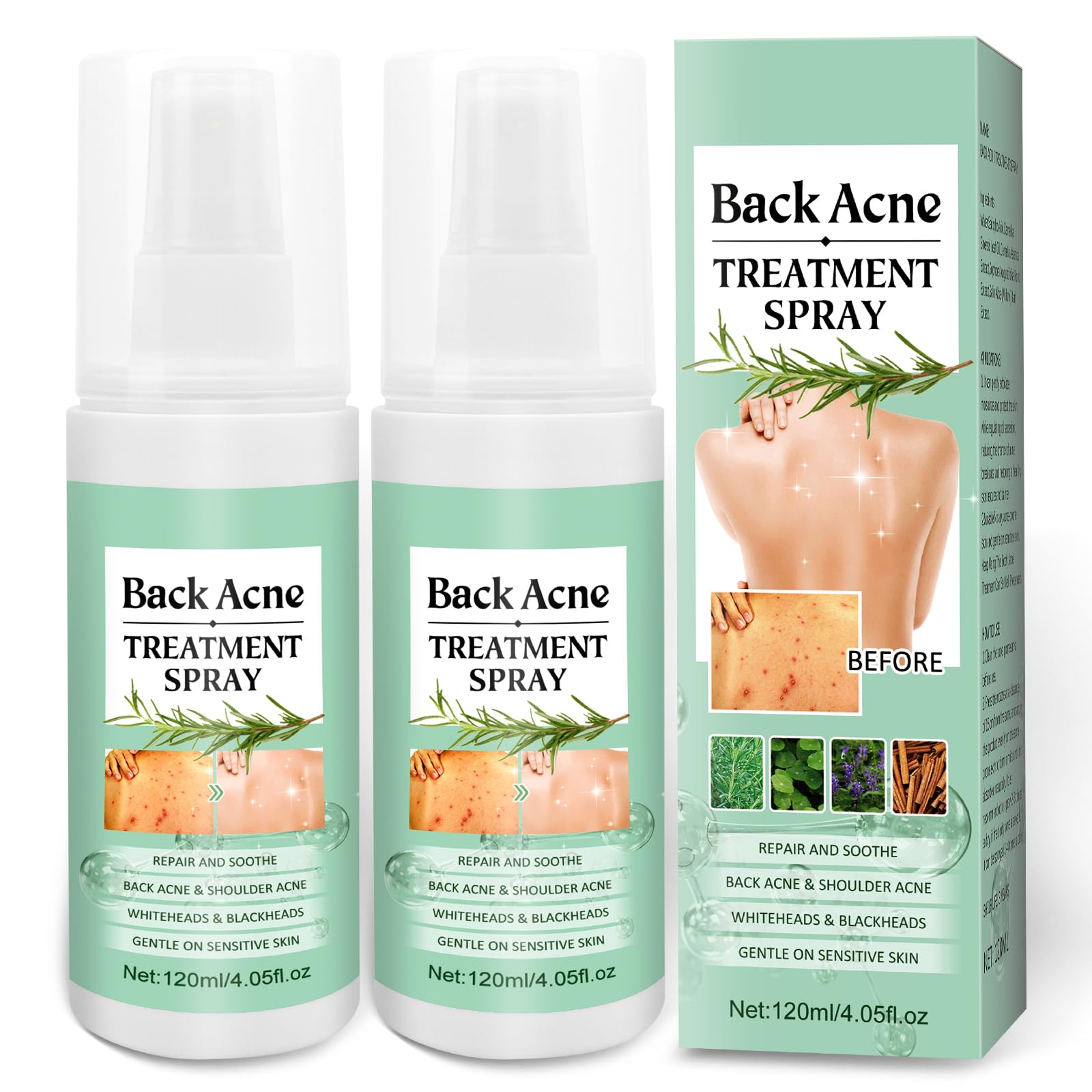 Back Acne Treatment With Herbal Formula, 2% Salicylic Acid & Tea Tree Oil - Body Spray Solution for Acne, 120ml (2PCS)
