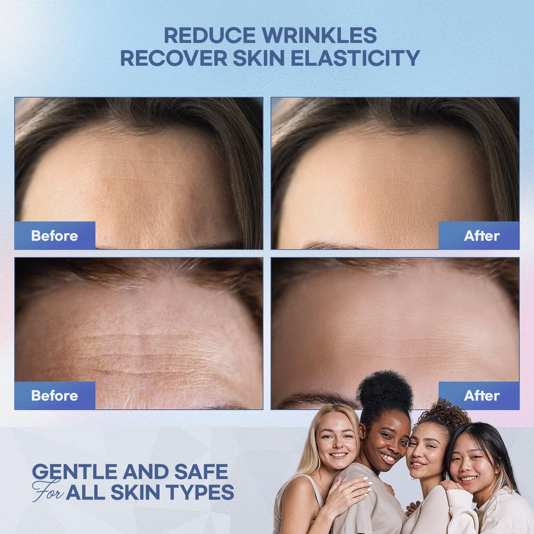 SILKDERMIS Forehead and Facial Wrinkle Patches: Anti Wrinkle Patches-Repair Winkle Remover and Treatment with Aloe Collagen and Vitamin E 12pcs