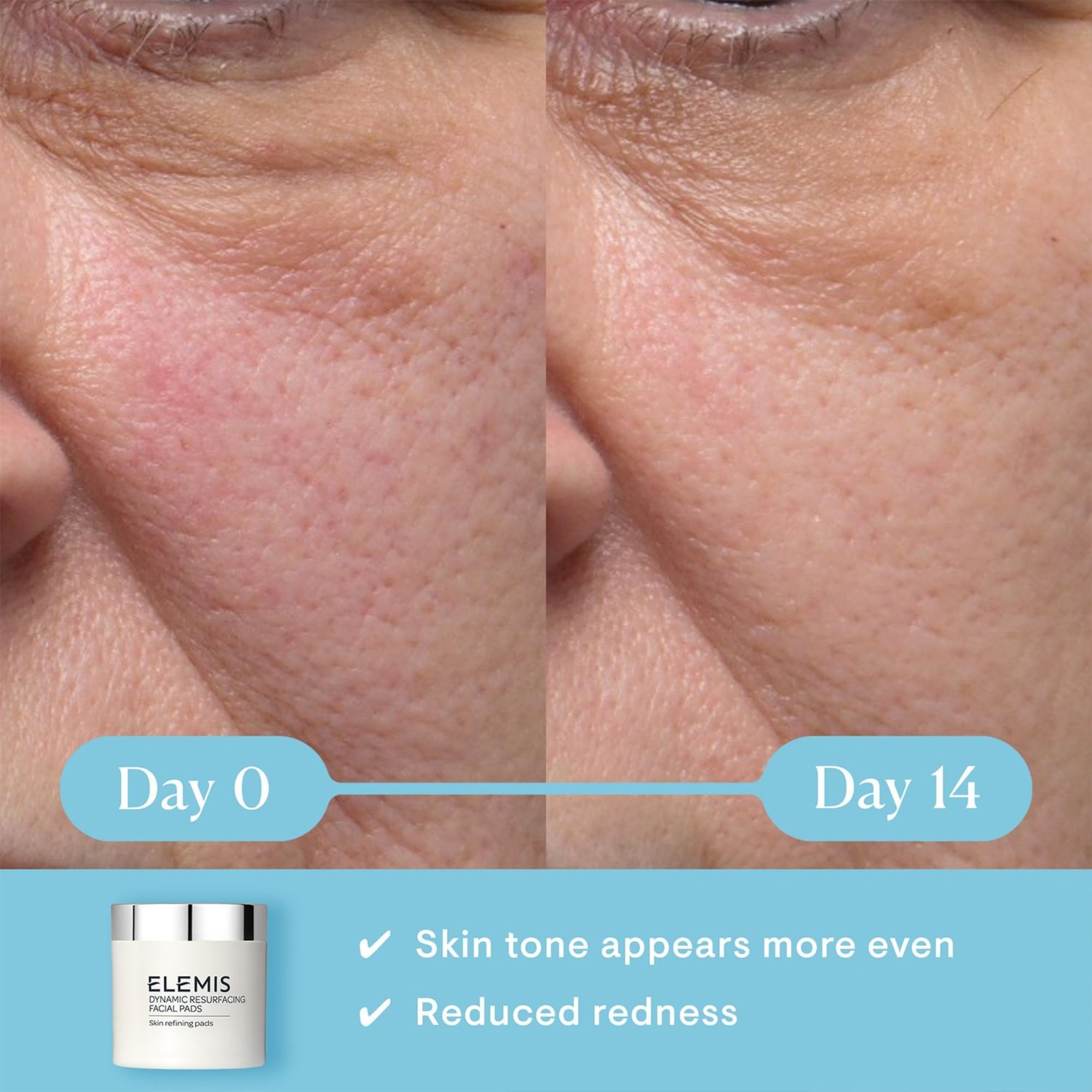 ELEMIS Dynamic Resurfacing Pads, Exfoliating Pads, Toner Pads, Chemical Exfoliant Face Toner, Lactic Acid Peel, Facial Cleansing Pads, Chemical Peel for Face