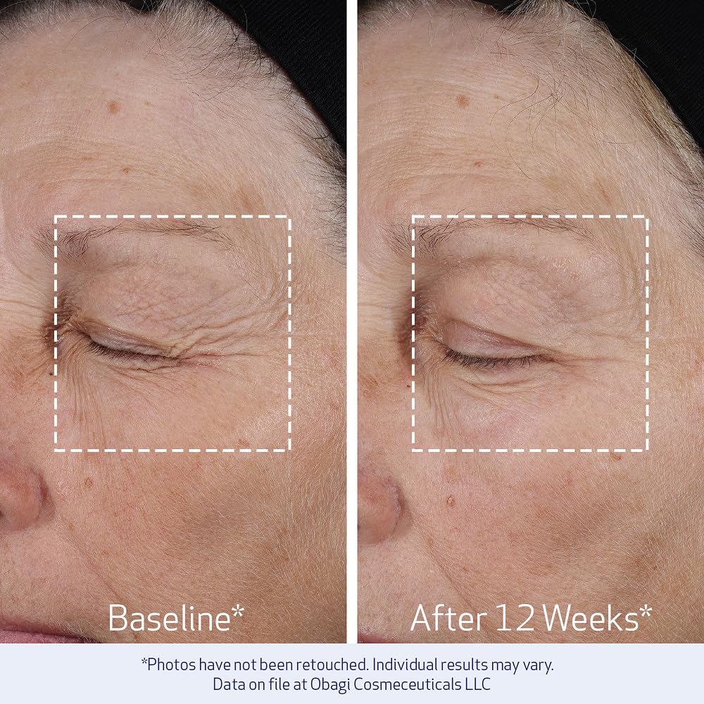 Obagi ELASTIderm Lift Up & Sculpt Facial Moisturizer – Clinically Proven Anti-Aging Face Cream that Visibly Firms & Sculpts Facial Contours, & Reduces Fine Lines & Wrinkles with Peptides – 1.7 oz