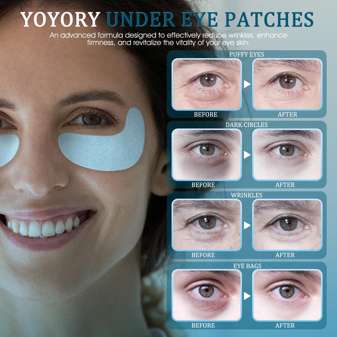 YOYORY Under Eye Patches Masks - for Dark Circles,Puffy Eyes, Wrinkles, Eye Bags,Fine Lines,Treatment with Hyaluronic Acid and Collagen, Hydrating and Moisturizing (30 Pcs)