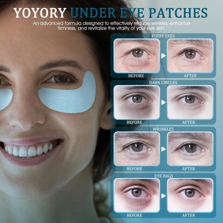 YOYORY Under Eye Patches Masks - for Dark Circles,Puffy Eyes, Wrinkles, Eye Bags,Fine Lines,Treatment with Hyaluronic Acid and Collagen, Hydrating and Moisturizing (30 Pcs)
