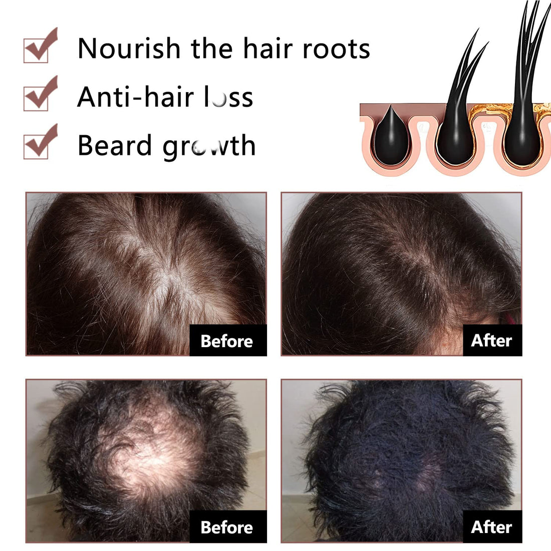 Black & Thick Hair Fallopia Multiflora Shampoo Bar,Polygonum Soap with Foaming Net,He Shou Wu Extract Shampoo,Deeply Cleanses Hair Scalp,Organic Moisturizes Repairs Hair Damage (3pcs)