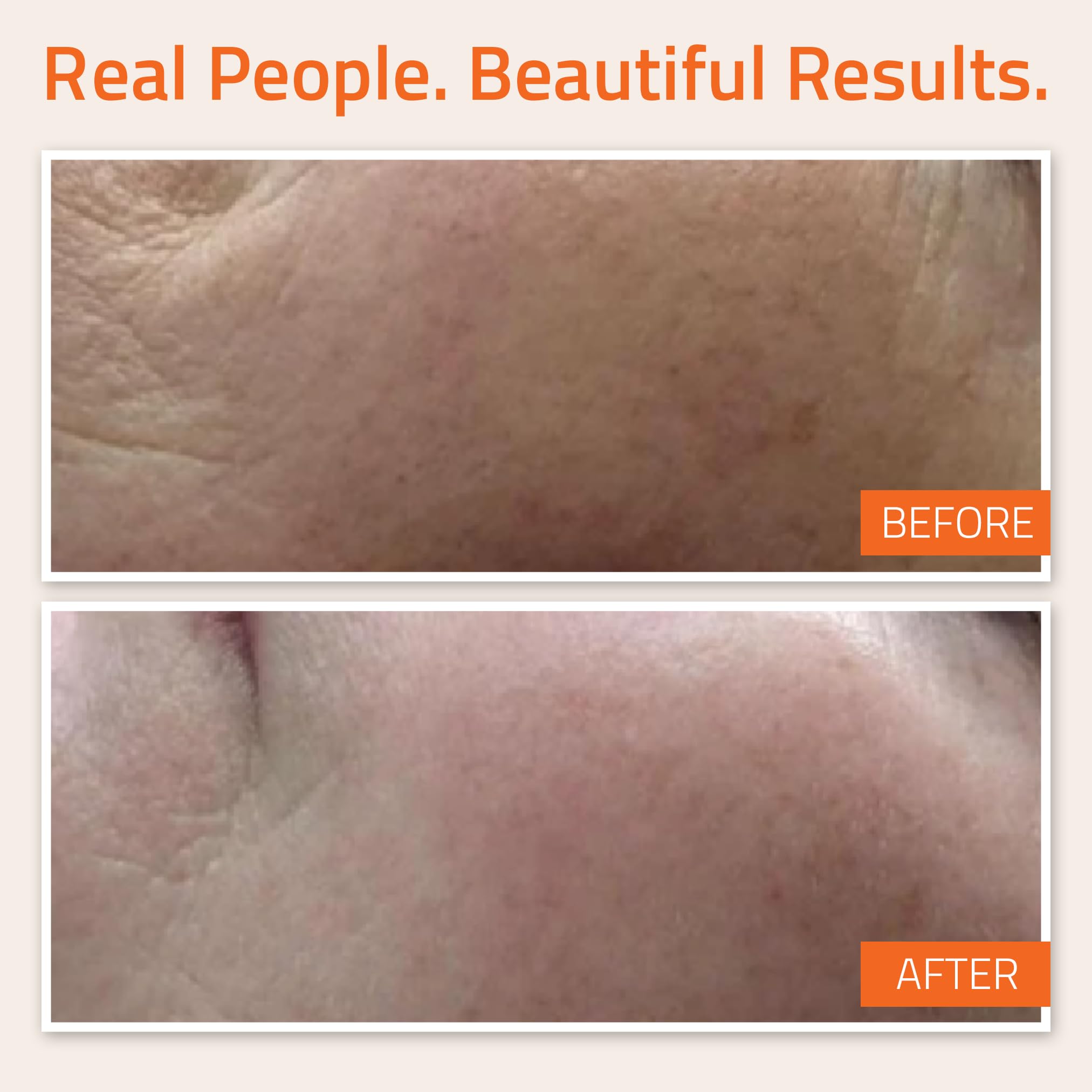 Yeouth Anti Aging Vitamin C Serum For Day With Hyaluronic Acid