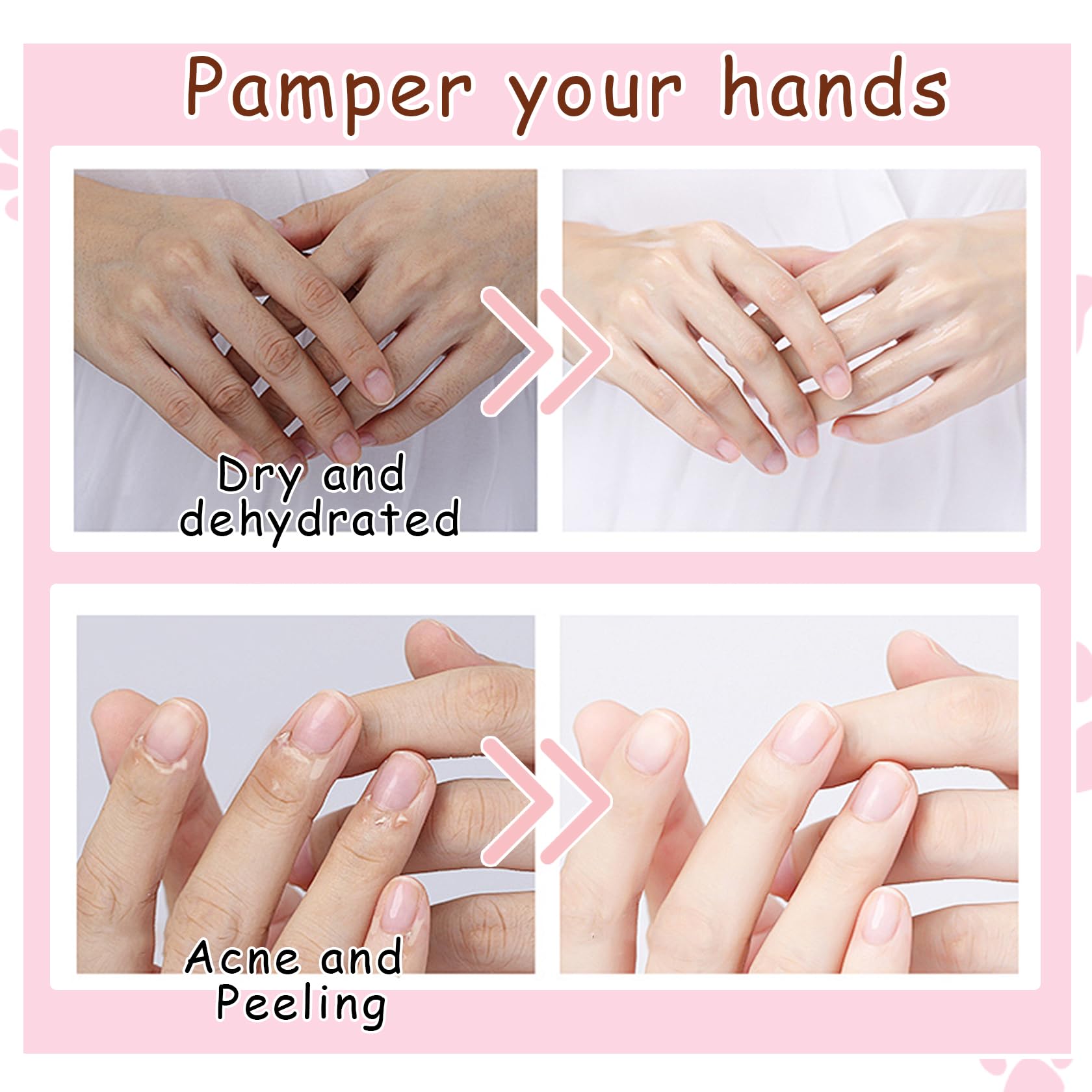 DWDiWen Hand Masks, 6 Pairs Hydrating Exfoliating Hand Peeling Mask, Smooth Hand Masks Moisturizing Gloves Overnight for Dry, Rough, Cracked Hands, Hand Skin Moisturizer Glove for Women Men(A