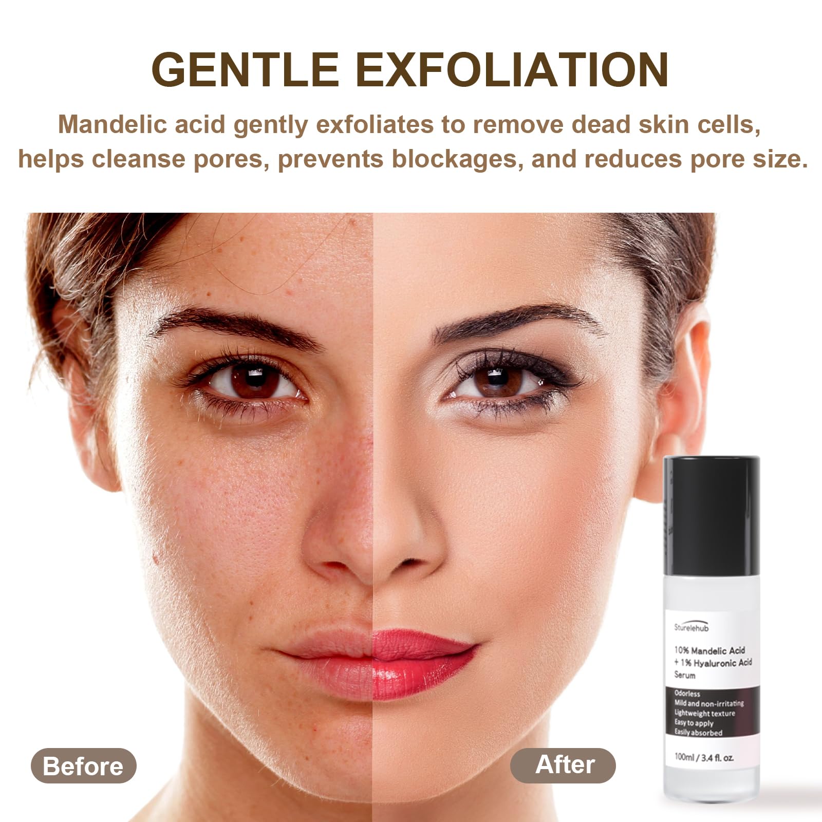 Mandelic Acid 10%+ Hyaluronic Acid 1% Serum, 3.4 fl. oz. / 100ml, Mandelic Acid Serum For Gentle Exfoliation, Mandelic Acid Toner For Face