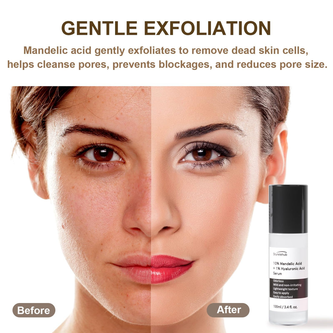 Mandelic Acid 10%+ Hyaluronic Acid 1% Serum, 3.4 fl. oz. / 100ml, Mandelic Acid Serum For Gentle Exfoliation, Mandelic Acid Toner For Face