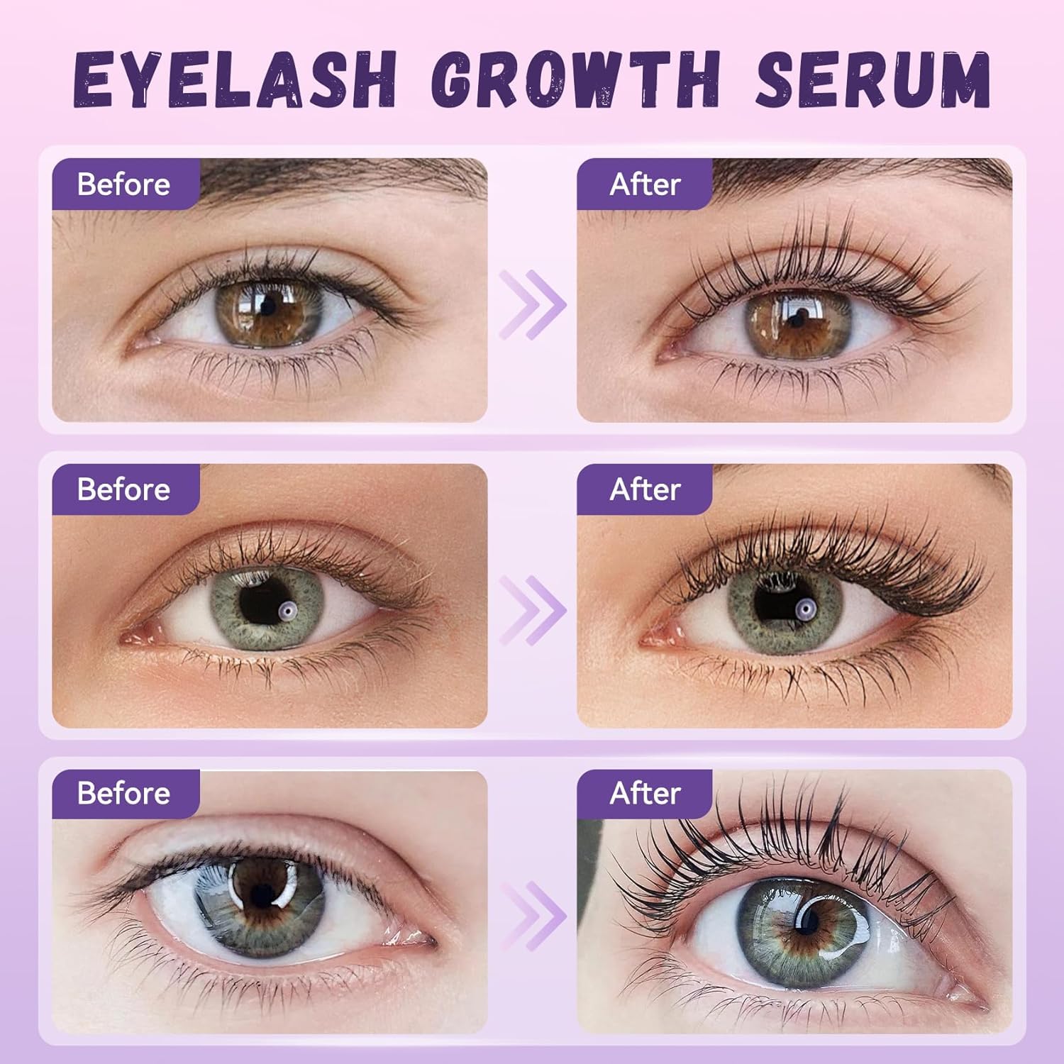 Eyelash Growth Serum, Premium Lash Serum Promotes Longer, Thicker, Fuller, Non-Irritating Eyelashes (5ml)