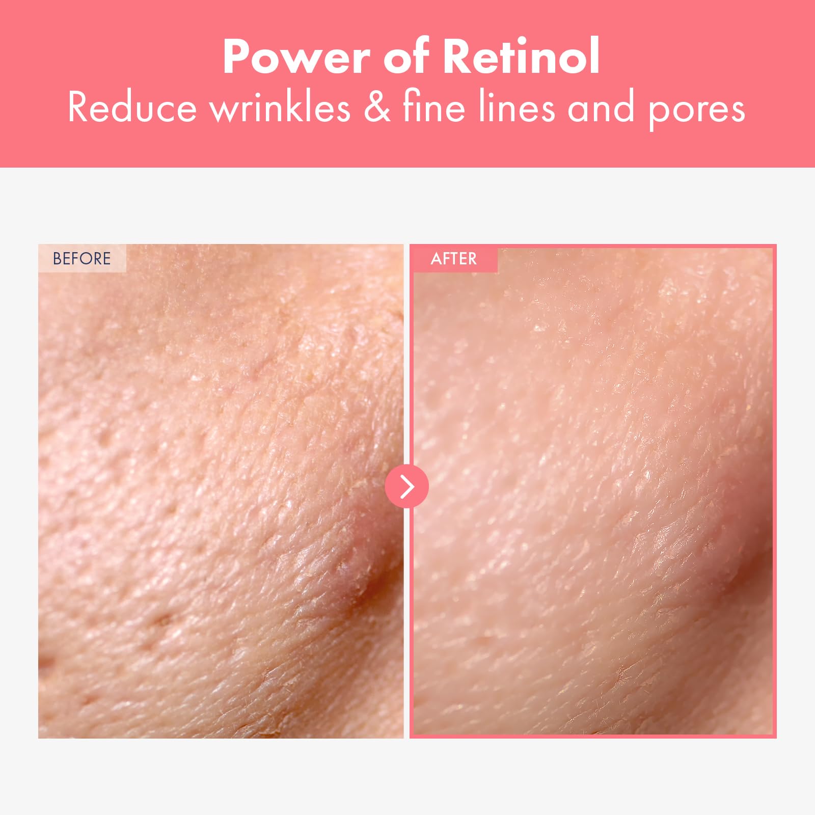 NATUREKIND Repair Retinol Cream, Liposomal Retinol 0.1%, Bakuchiol, Retinal, niacinamide, Anti Aging for Face, Eye, Fine Lines & Wrinkles Treatment, Pure Vitamin A, Korean Skincare, 50g, 1.76 oz.