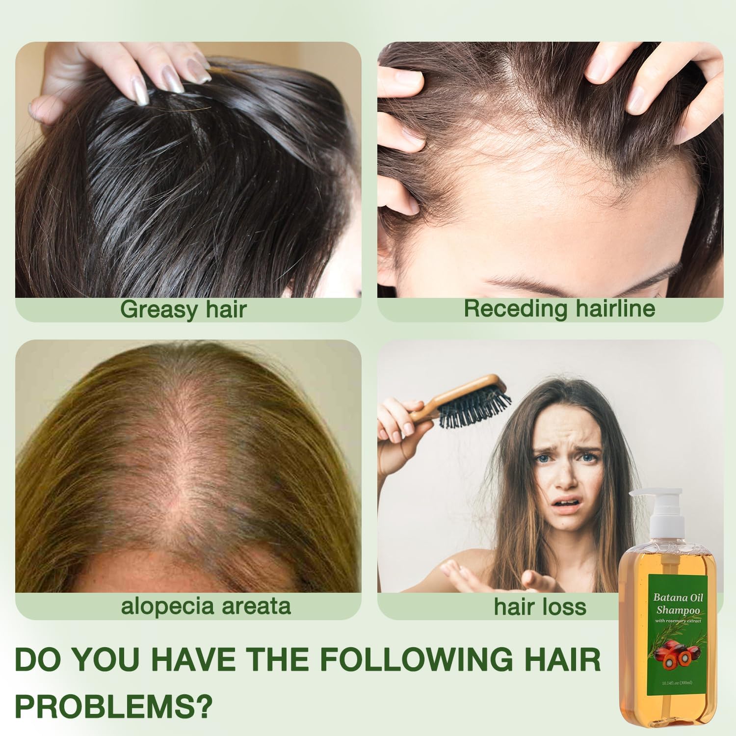 VOKSODHCK Batana Oil & Rosemary Shampoo, Shampoo De Batana, Batana Shampoo with Rosemary Extract, Nourishing & Regenerating Hair- Soft and Fluffy for Men & Women - 10.14 fl oz