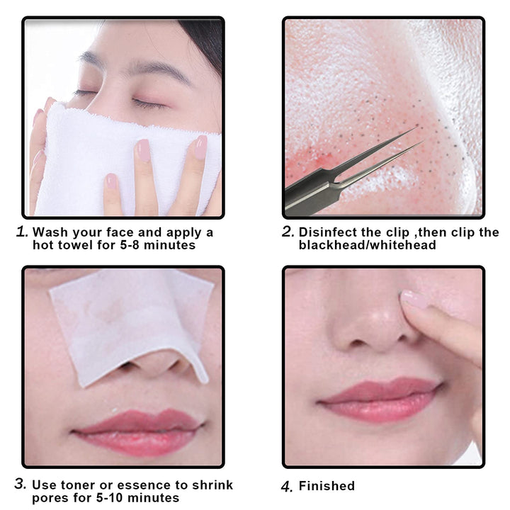 MUZE Professional Facial Milia Removal and Whitehead Pointed Tweezers - Precision Sharp Needle Nose Tool for Blackhead ,Pimple Popper & Fat Particles Remover - Zit and Pimple Acne Removal