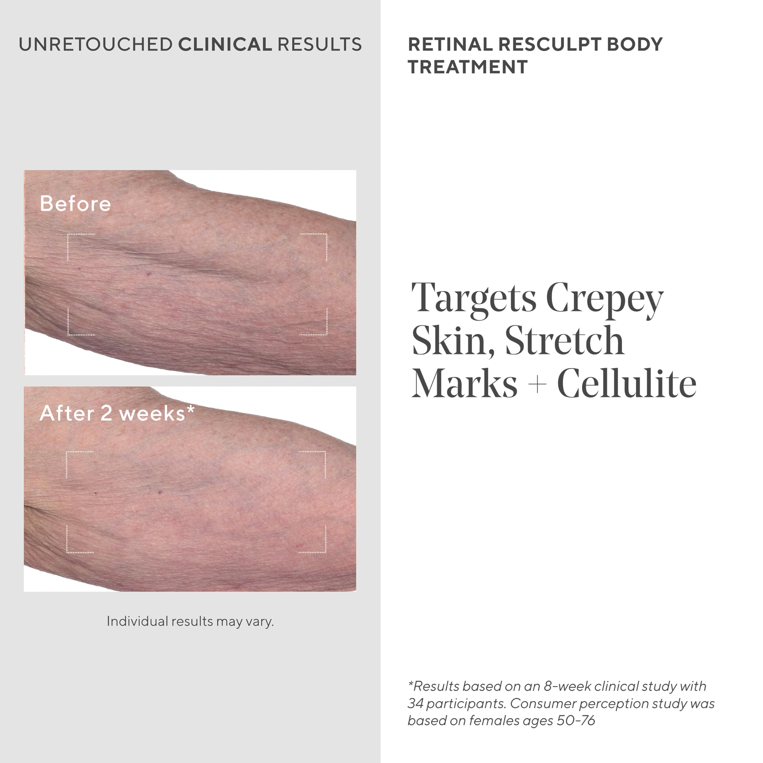 Retinal ReSculpt Body Treatment - Retinal Body Cream to Target Cellulite and Stretch Marks - Lifts, Firms, and Tightens Sagging, Crepey Skin, 5.0 Fl Oz