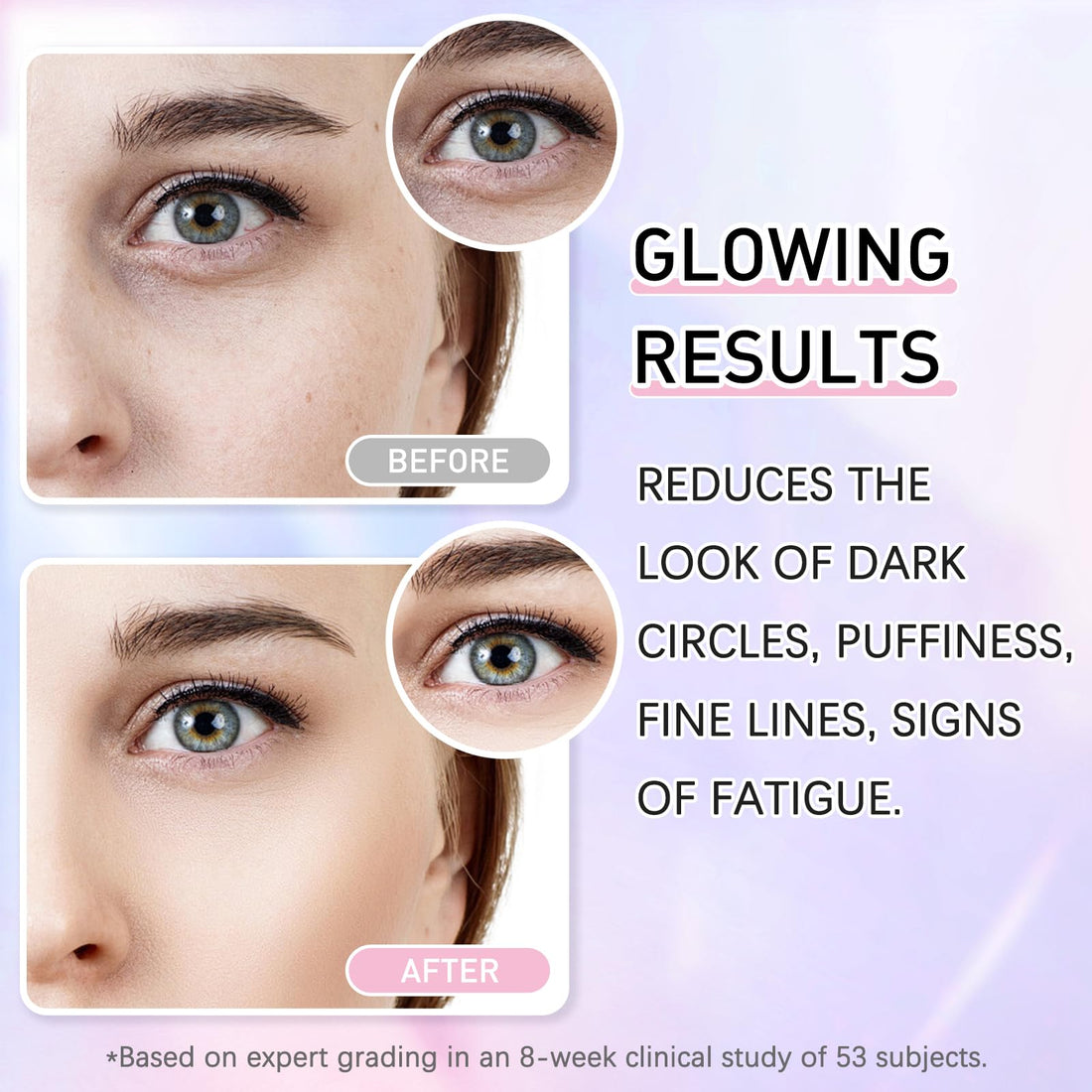 Caffeine Eye Serum Cream Kit for Dark Circles Under Eye Treatment Anti Aging For Puffiness Bags And Wrinkles 2 Fl Oz