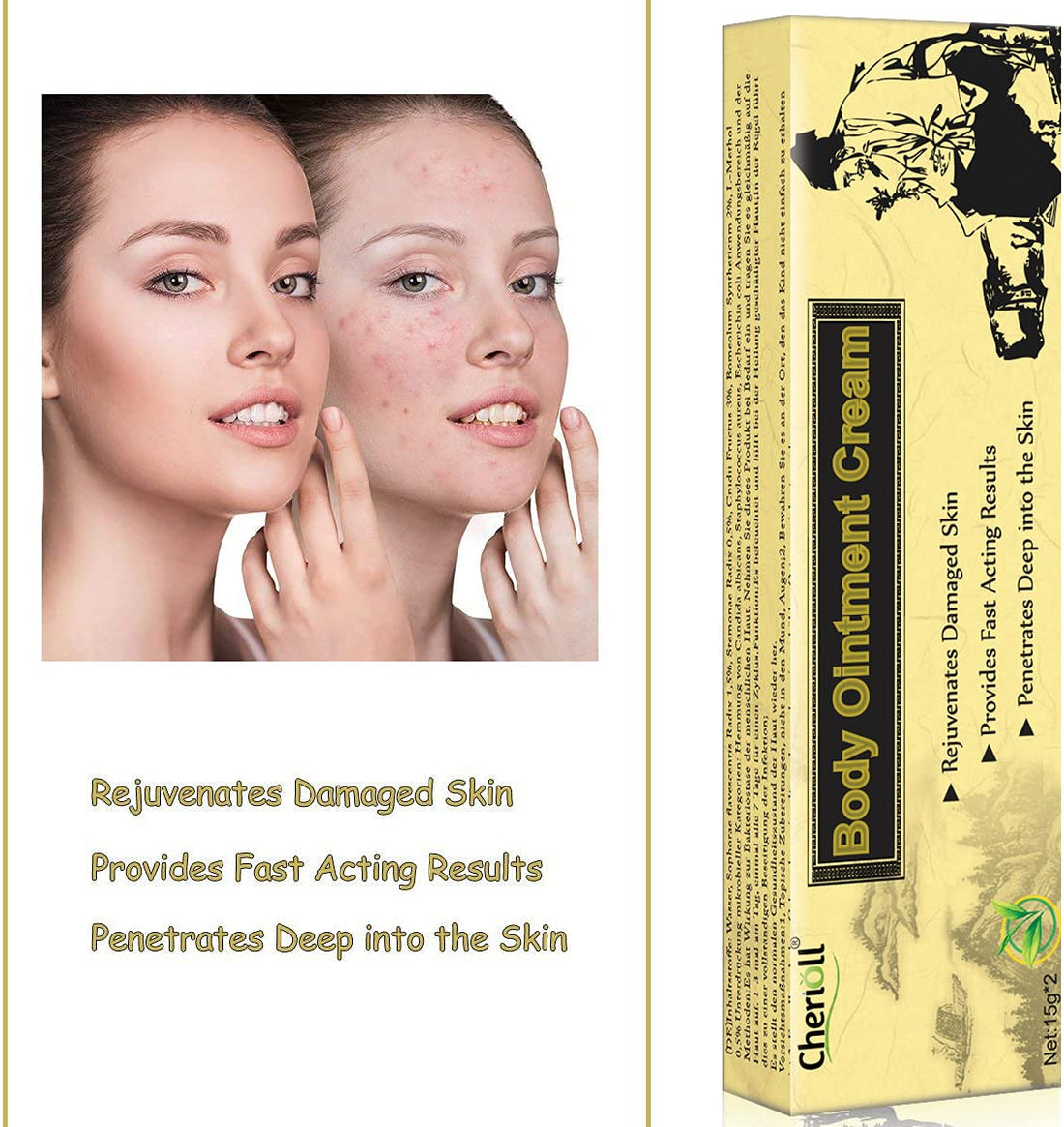 Moisturising Cream, Body and Face Moisturizer for Dry Skin, Acne Cream, 2PC