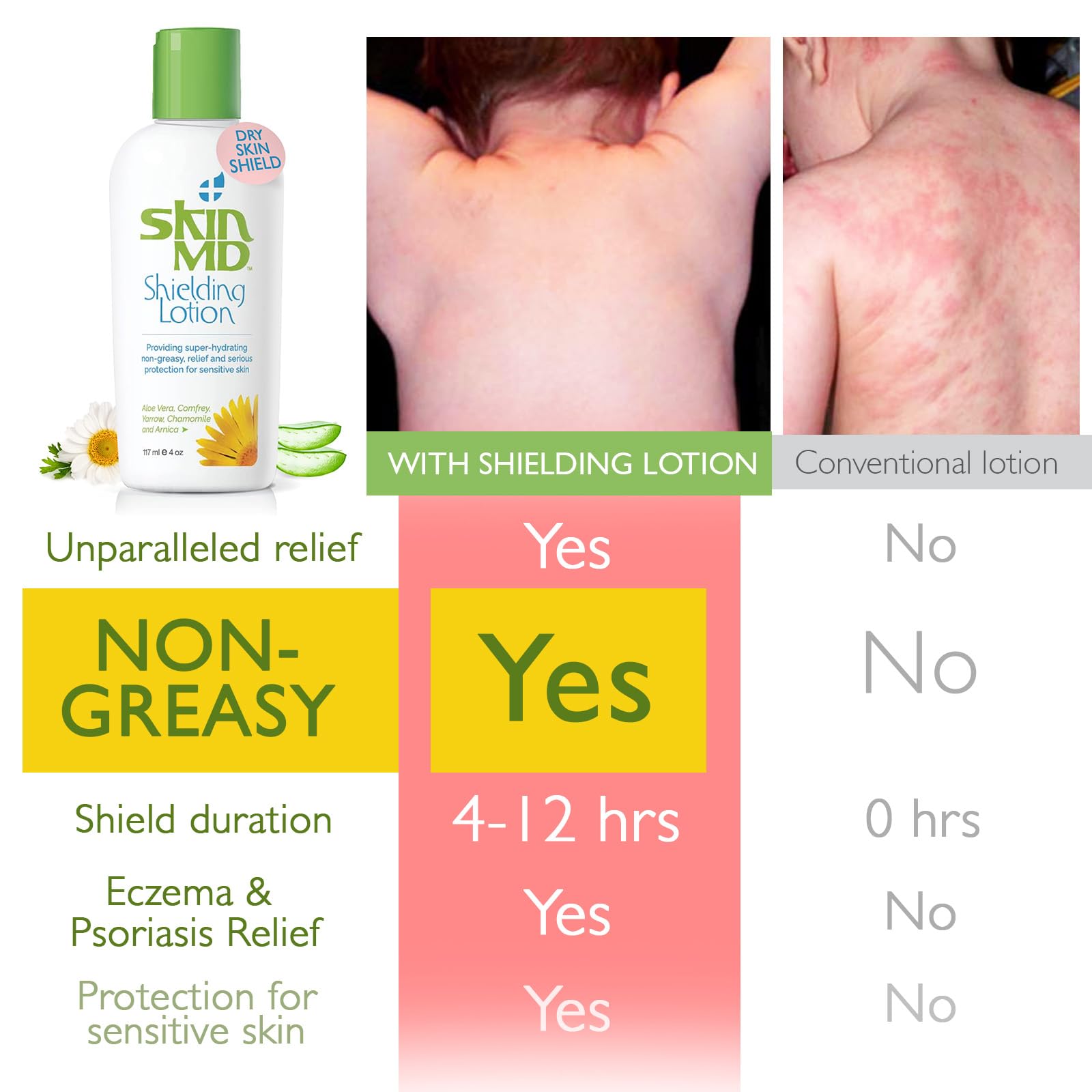 Skin MD Natural Shielding Lotion 4 Oz. Bottle (117 mL) for Hands Face & Body