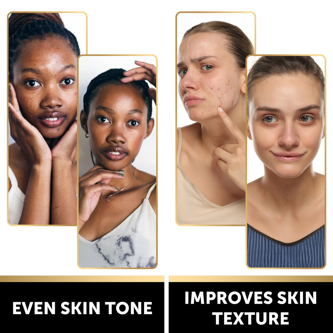 VALITIC Snail Mucin Cleanser Soap Bar with Turmeric and Kojic Acid Dark Spot Corrector – Anti Aging and Purifying Skin Care Snail Secretion for Intense Hydration and Moisturization – 4 Pack