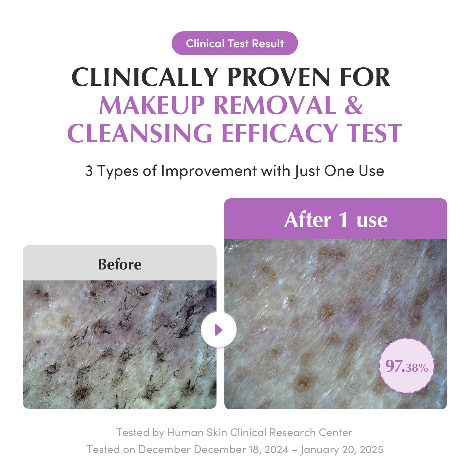 EQQUALBERRY Purple Rice Pore Smoothing Cleansing Oil – Deep Cleansing for Pores & Blackheads | Korean Oil Cleanser for Face & Makeup Remover | Hydrating & Soothing Formula, 6.76 fl.oz