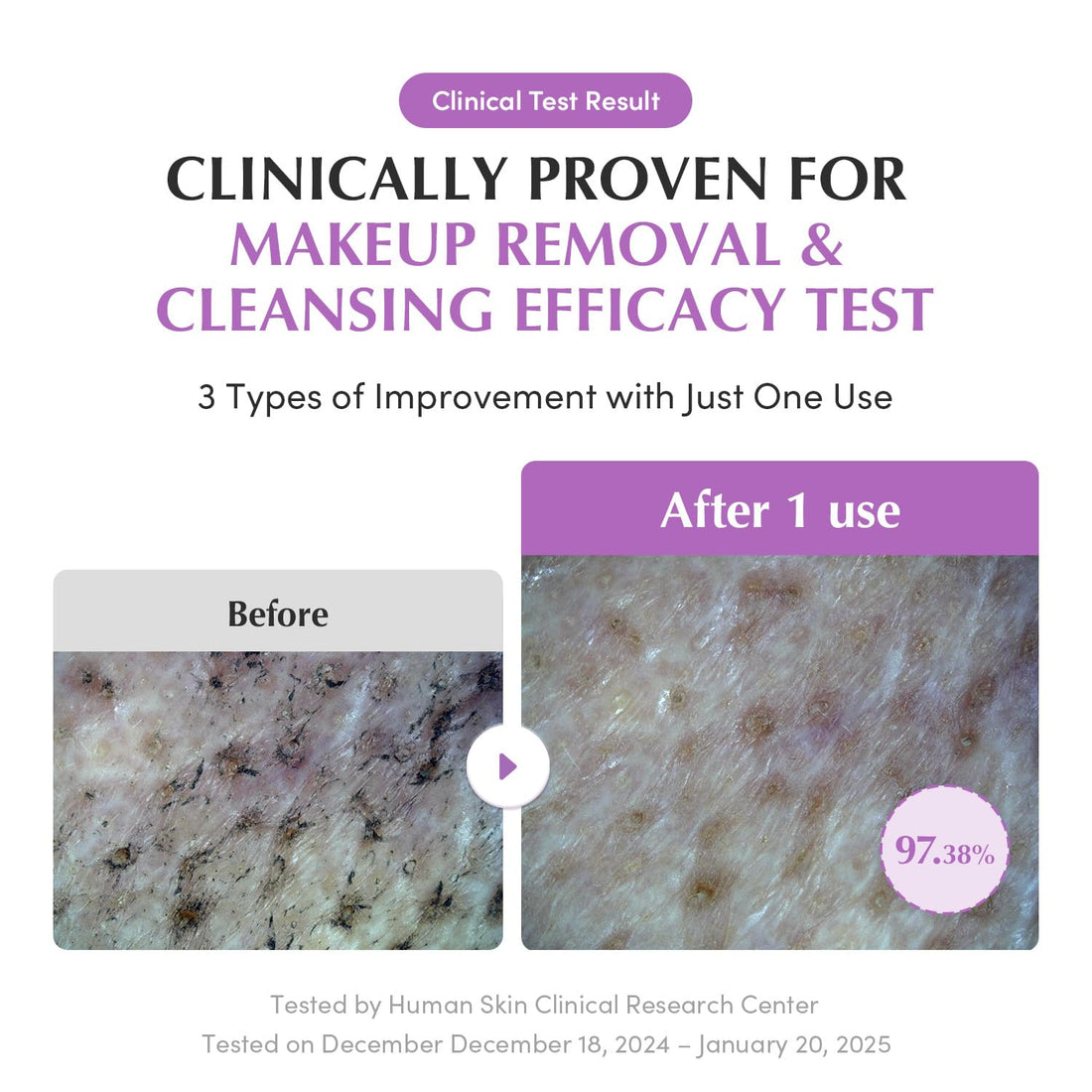 EQQUALBERRY Purple Rice Pore Smoothing Cleansing Oil – Deep Cleansing for Pores & Blackheads | Korean Oil Cleanser for Face & Makeup Remover | Hydrating & Soothing Formula, 6.76 fl.oz