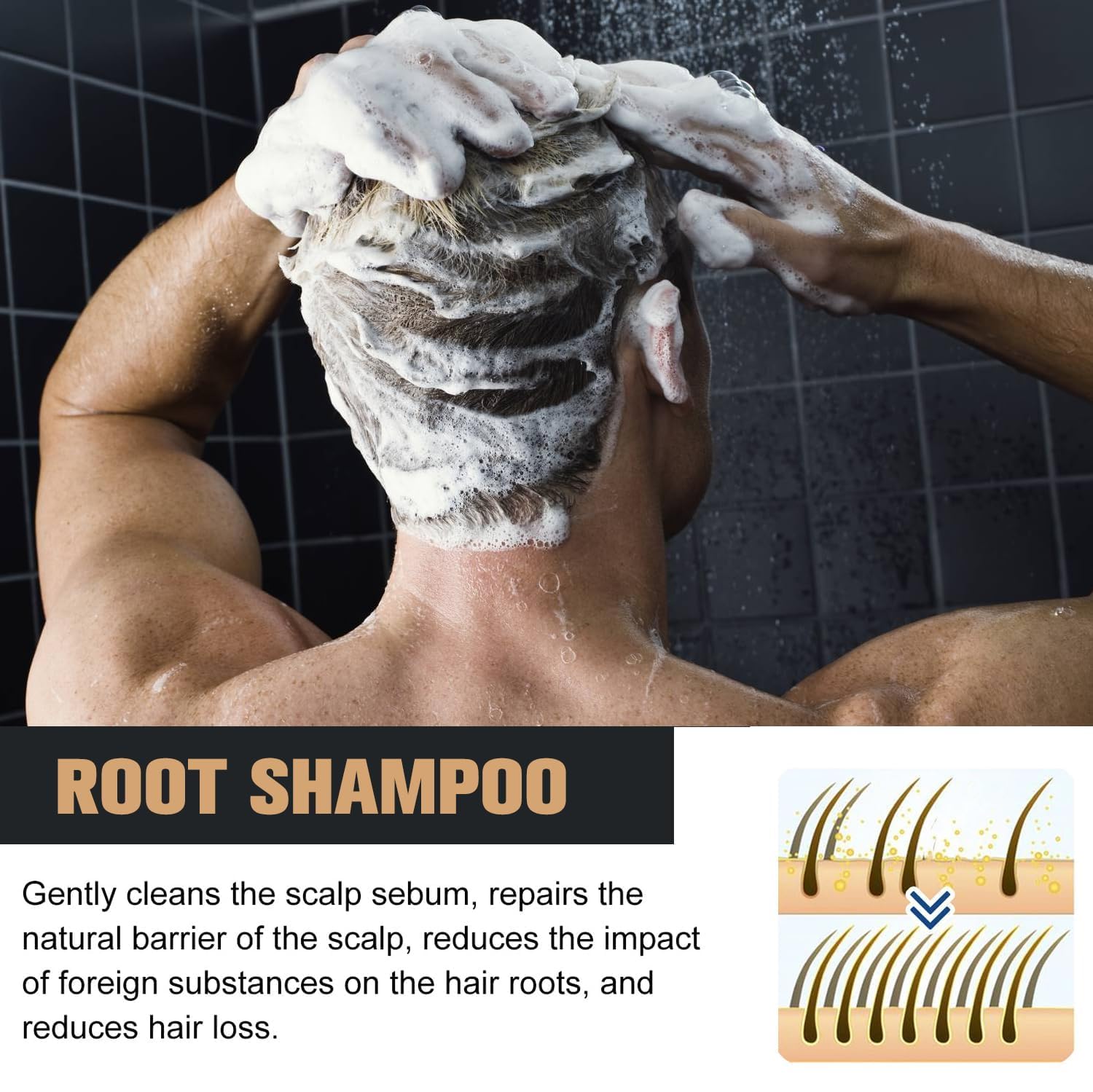 2 Pcs Root Activator Shampoo, Hair Growth Root Activator Shampoo, For Anti-Hair Loss, Natural Formula for Men and Women