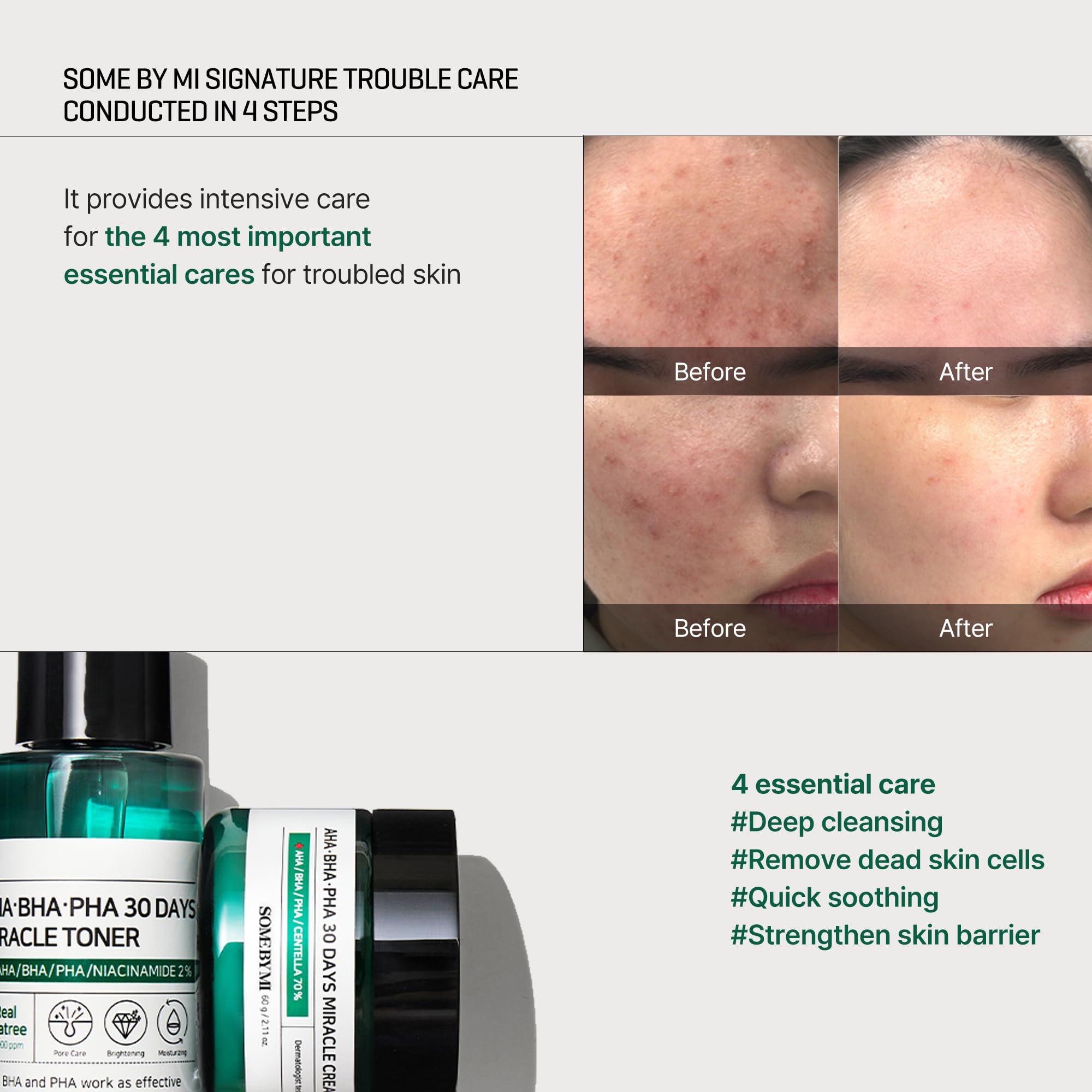 SOME BY MI AHA BHA PHA 30Days Starter Kit - Toner 1.01Oz, Serum 0.33Oz, Cream 0.7Oz, Cleansing Bar 1.05Oz - Mild Exfoliating Daily Skin Care Set - Skin Wastes, Sebum, Oiliness Care - Korean Skin Care