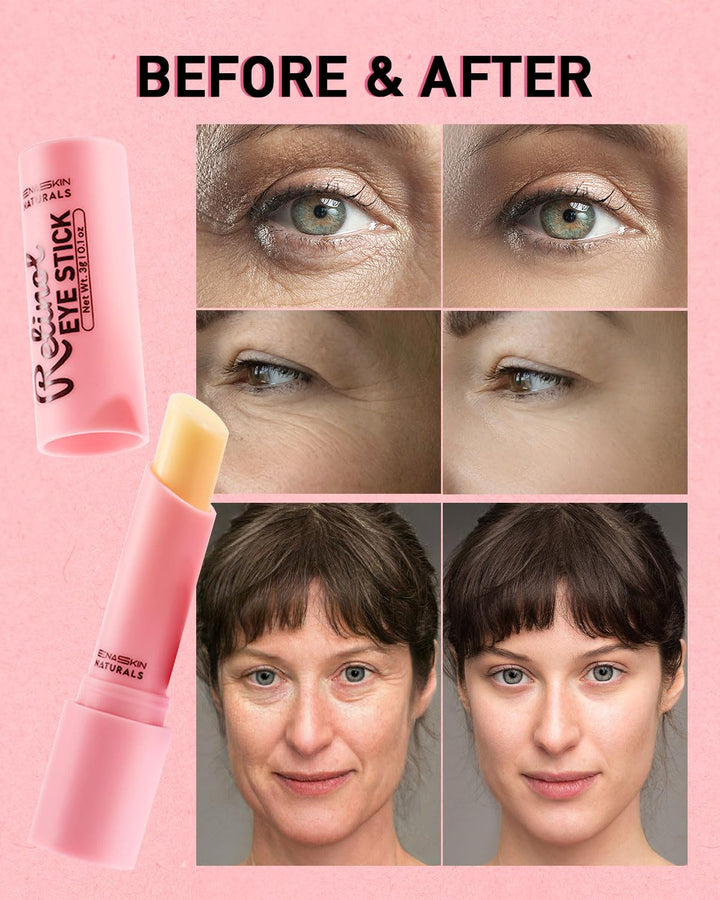 Under Eye Stick For Puffiness: Retinol Under Eye Balm Reducing Eye Bags and Dark Circles - Eye Cream for Fine Lines Wrinkles and Puffiness, Eye Treatment for Late Nights, Overtime and Makeup Prep