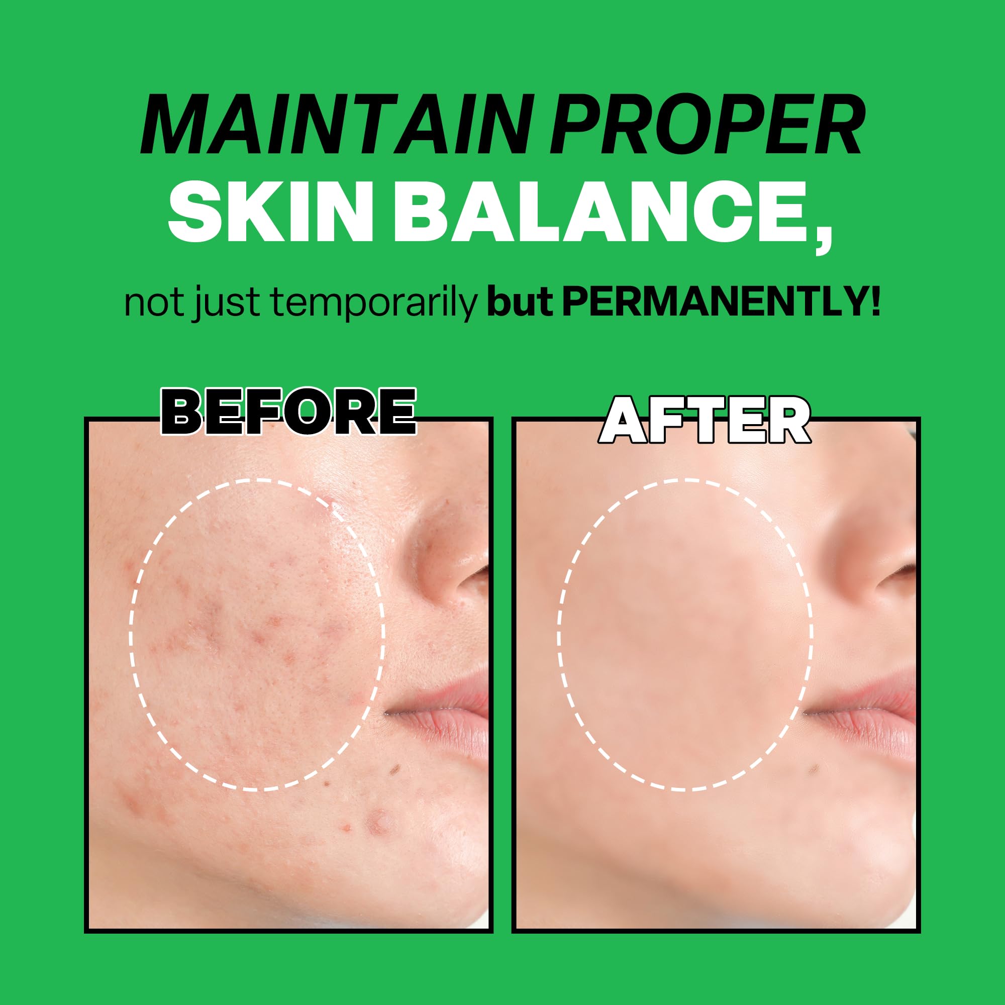 Troubless Mild Clear Toner Essence - Tea Tree Facial Toner for All Skin Types | Hydrating Skin Toner, Daily Skin Care (6.76 fl oz)