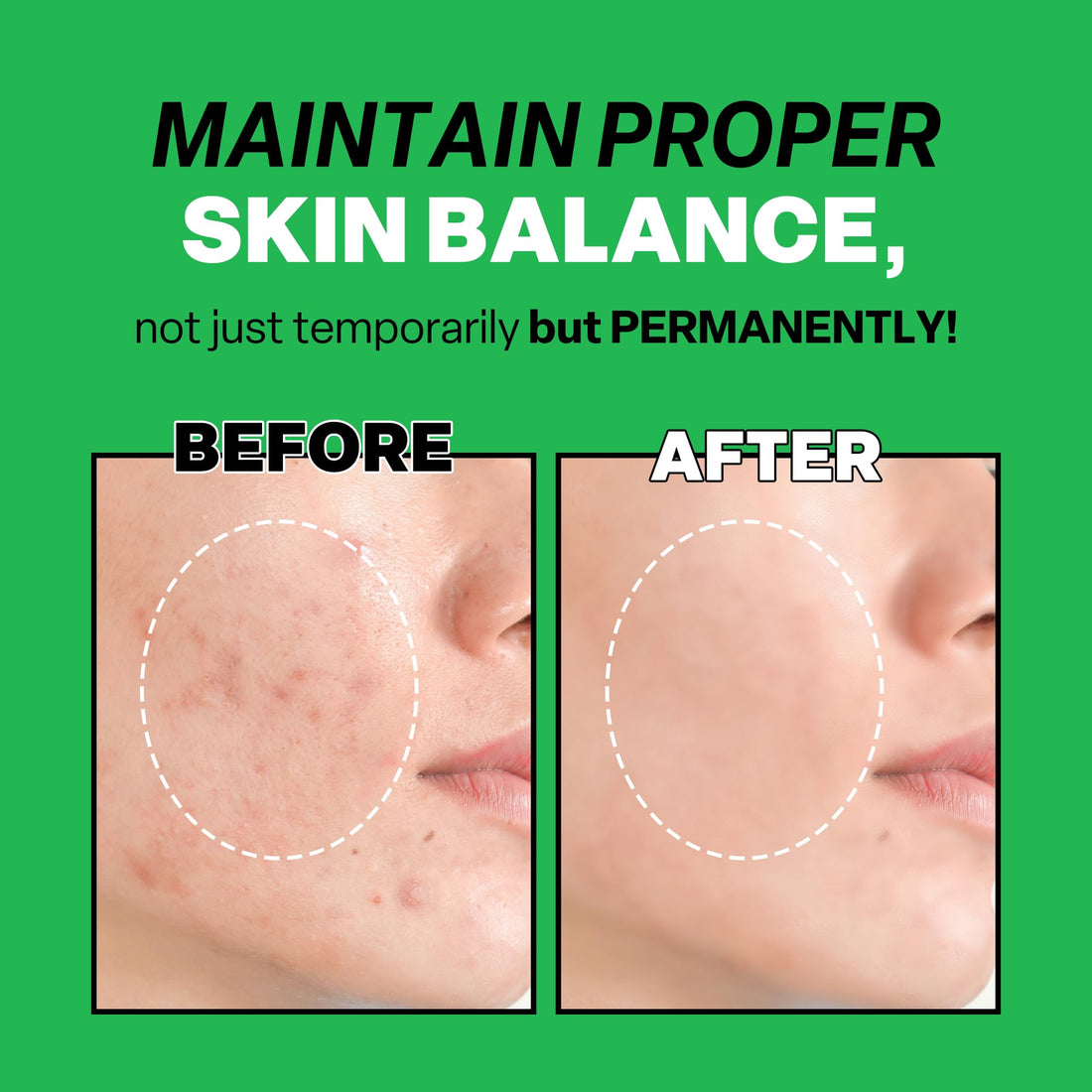 Troubless Mild Clear Toner Essence - Tea Tree Facial Toner for All Skin Types | Hydrating Skin Toner, Daily Skin Care (6.76 fl oz)