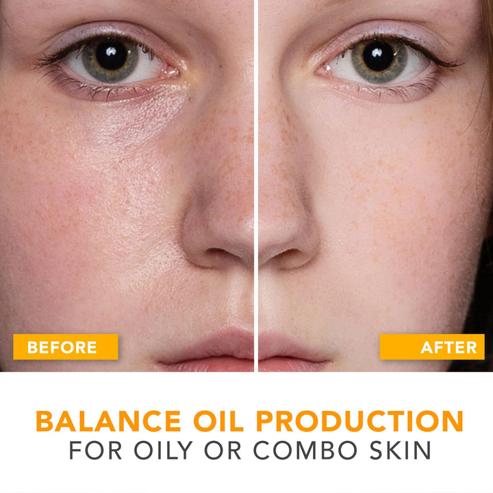 Facial Moisturizer Organic and Natural Daily Face Moisture Cream for Sensitive, Oily or Combo Skin; Light and Soothing; Best Non-Greasy Oil Control Lotion, Anti-Aging, Anti-Wrinkle for Men and Women