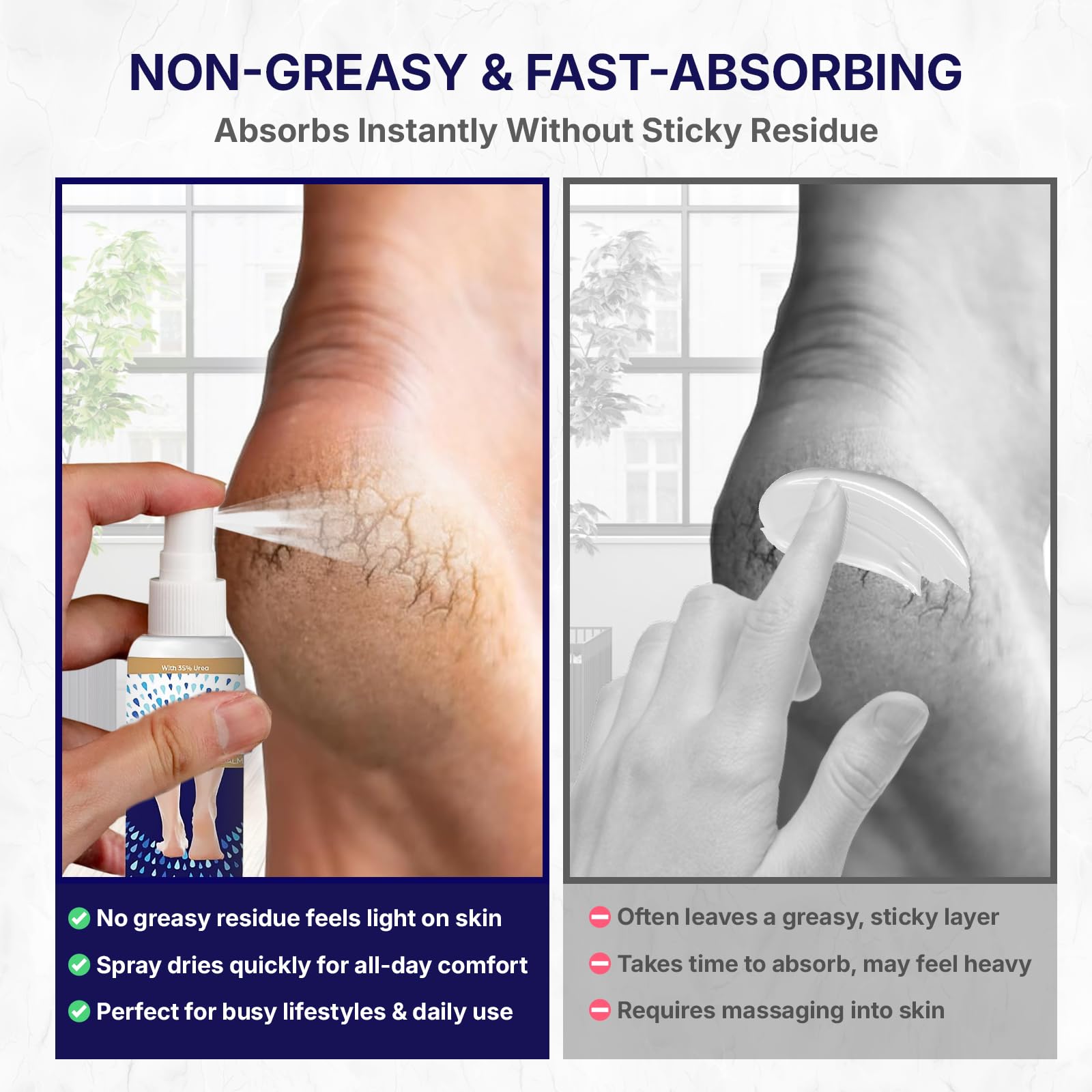 URESPRAY 35% Urea Foot & Heel Spray - 125ML Moisturizing Treatment for Dry, Cracked Feet, Heels, Knees & Elbows - Intensive Skin Repair, Callus Remover, Dead Skin Care & Cuticle Softener Spray