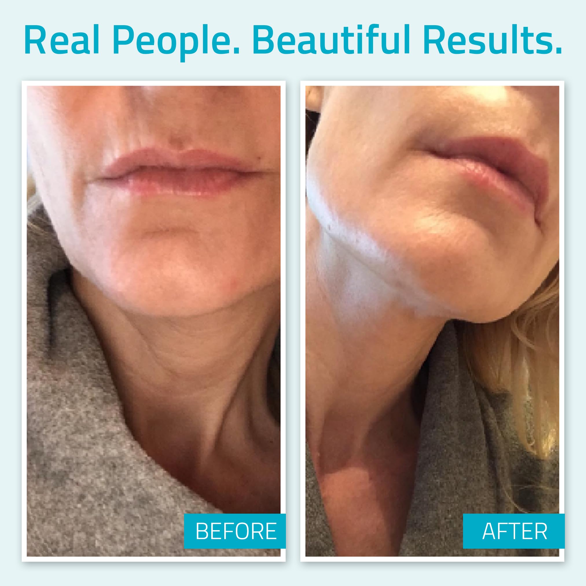 YEOUTH Day Night Cream for Face with Hyaluronic Acid, Snail Mucin and Copper Tripeptide - Moisturizer Face Cream - Hydrating Face Moisturizer for Women and Men 4oz - Face Moisturizer