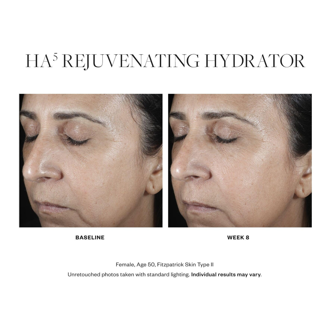 SkinMedica HA 5 Rejuvenating Hydrator Full Size 2oz