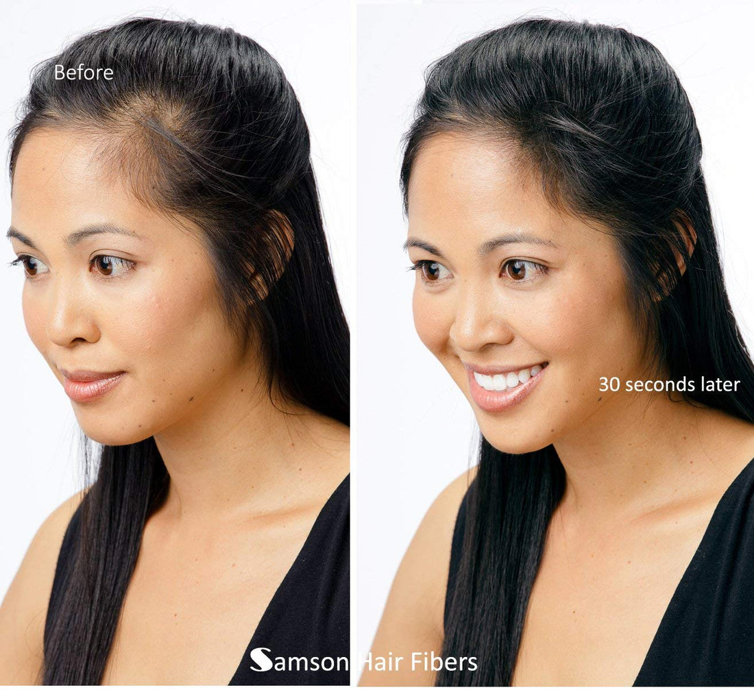 Refill Kit Hair Building Fibers Black By Samson Large 25 Grams Made In Usa Hair Loss Concealer