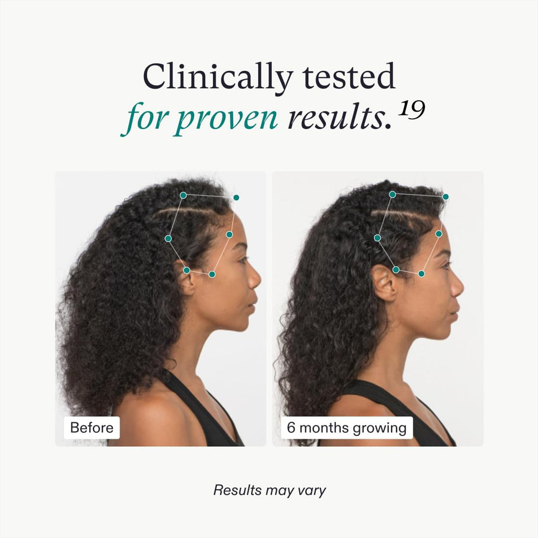 Nutrafol Women's Hair Growth Supplements, For Women 18-44 Years Old, Clinically Tested for Visibly Thicker, Stronger Hair, 100% Vegan Ingredients, Dermatologist Recommended - 1 Month Supply