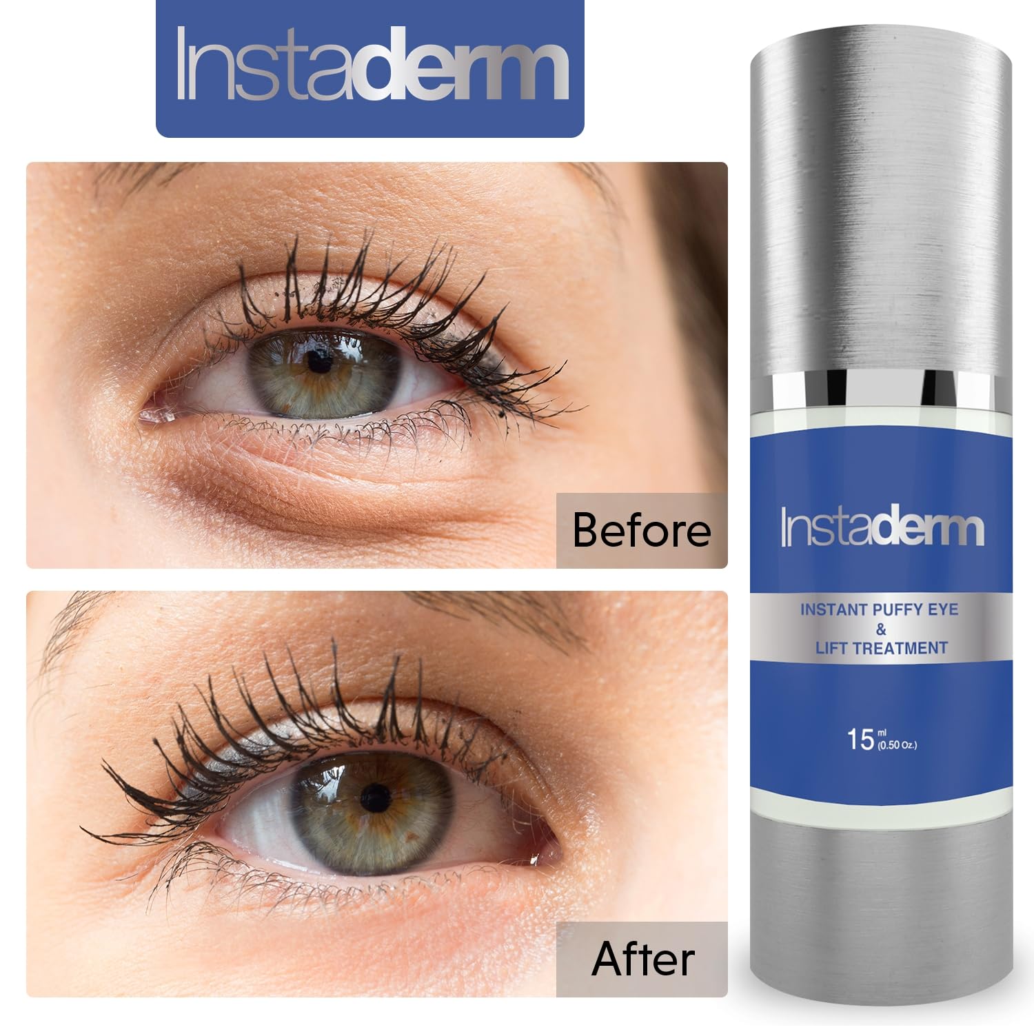 Instant Puffy Eye & Lift Treatment ââ‚¬â€œ Removes Under Eye Bags & Puffiness. Eliminate Dark Circles & Wrinkles. Naturally Ageless Hydrating Cream. Disappears Before Your Eyes Within Minutes.