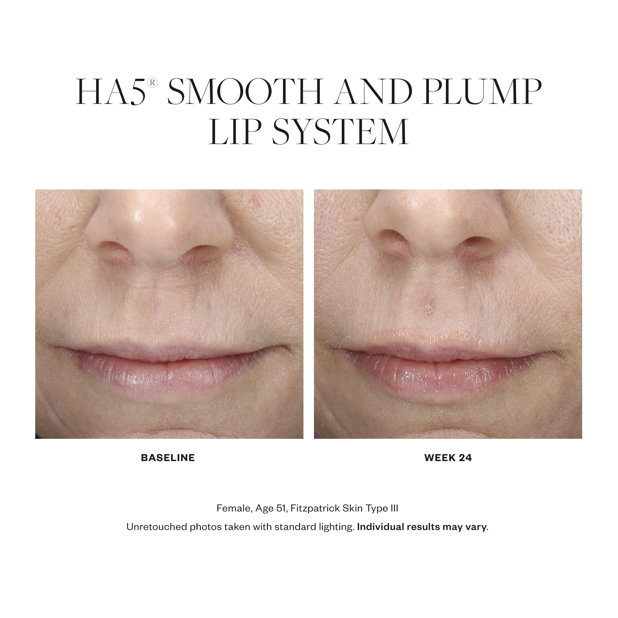 SkinMedica HA5 Smooth and Plump Lip System