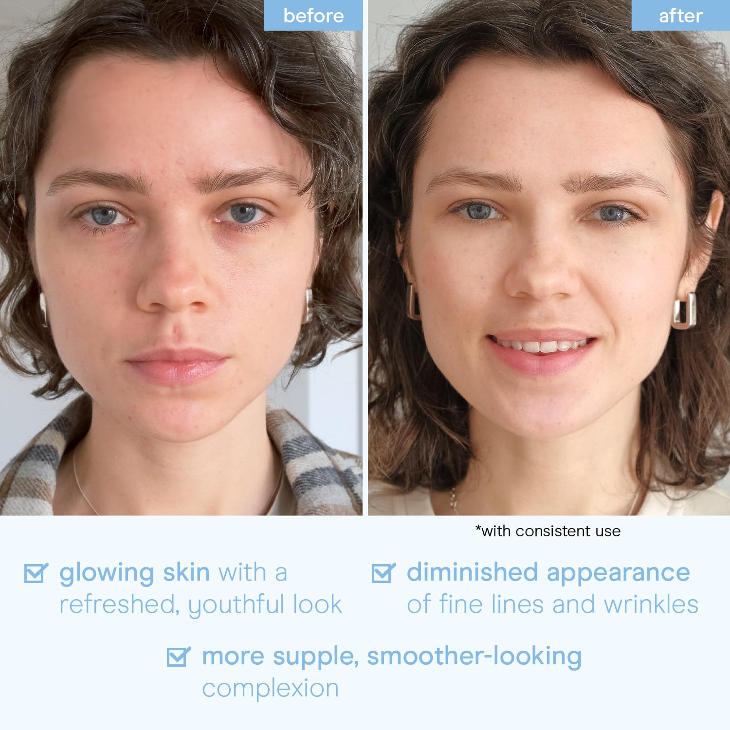 Baebody Snail Mucin Face Sheet Mask (6 pcs) - Anti Aging and Moisturizing Face Mask with Hyaluronic Acid - Deep Hydration for Youthful Skin